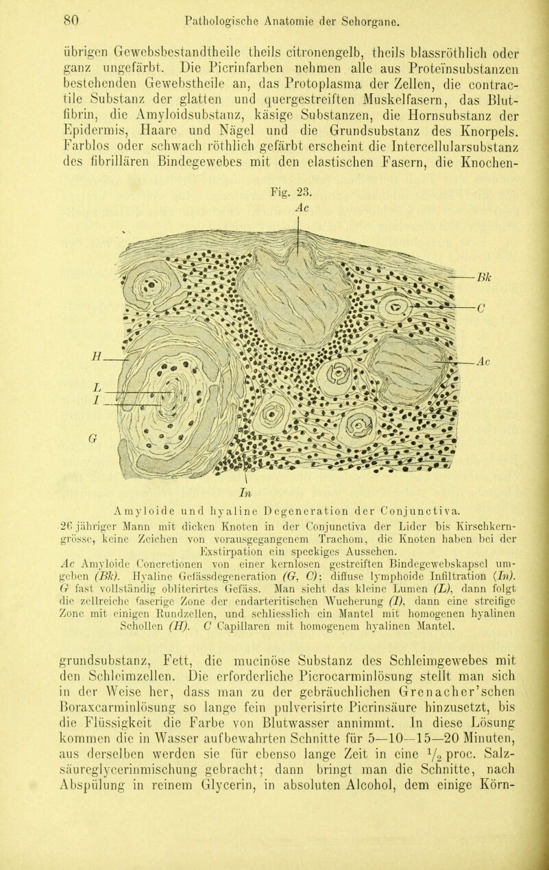 übrigen Gewebsbestandtheile theils citronengelb, theils blassröthlich oder ganz ungefärbt. Die Picrinfarben nehmen alle aus Proteinsubstanzen bestehenden Gewebstheile an, das Protoplasma der Zellen, die contrac- tile Substanz der glatten und quergestreiften Muskelfasern, das Blut- fibrin, die Amyloidsubstanz, käsige Substanzen, die Hornsubstanz der Epidermis, Haare und Nägel und die Grundsubstanz des Knorpels. Farblos oder schwach röthlich gefärbt erscheint die Intercellularsubstanz des fibrillären Bindegewebes mit den elastischen Fasern, die Knochen- Fig. 23. Äc Amyloide und hyaline Degeneration der Conjunctiva. 26 jähriger Mann mit dicken Knoten in der Conjunctiva der Lider bis Kirschkern- grösse, keine Zeichen von vorausgegangenem Trachom, die Knoten haben bei der Exstirpation ein speckiges Aussehen. Äc Amyloide Concretionen von einer kernlosen gestreiften Bindegewebskapsel um- geben (Bk). Hyaline Gefässdegeneration (G, C); diffuse lymphoide Infiltration (In). G fast vollständig obliterirtes Gefäss. Man sieht das kleine Lumen (L), dann folgt die zellreiche faserige Zone der endarteritischen Wucherung (I), dann eine streifige Zone mit einigen Rundzellen, und schliesslich ein Mantel mit homogenen hyalinen Schollen (H). C Capillaren mit homogenem hyalinen Mantel. grundsubstanz, Fett, die mucinöse Substanz des Schleimgewebes mit den Schleimzellen. Die erforderliche Picrocarminlösung stellt man sich in der Weise her, dass man zu der gebräuchlichen Grenacher'schen Boraxcarminlösung so lange fein pulverisirte Picrinsäure hinzusetzt, bis die Flüssigkeit die Farbe von Blutwasser annimmt. In diese Lösung kommen die in Wasser aufbewahrten Schnitte für 5—10—15—20 Minuten, aus derselben werden sie für ebenso lange Zeit in eine 1/2 proc. Salz- säureglycerinmischung gebracht; dann bringt man die Schnitte, nach Abspülung in reinem Glycerin, in absoluten Alcohol, dem einige Körn-