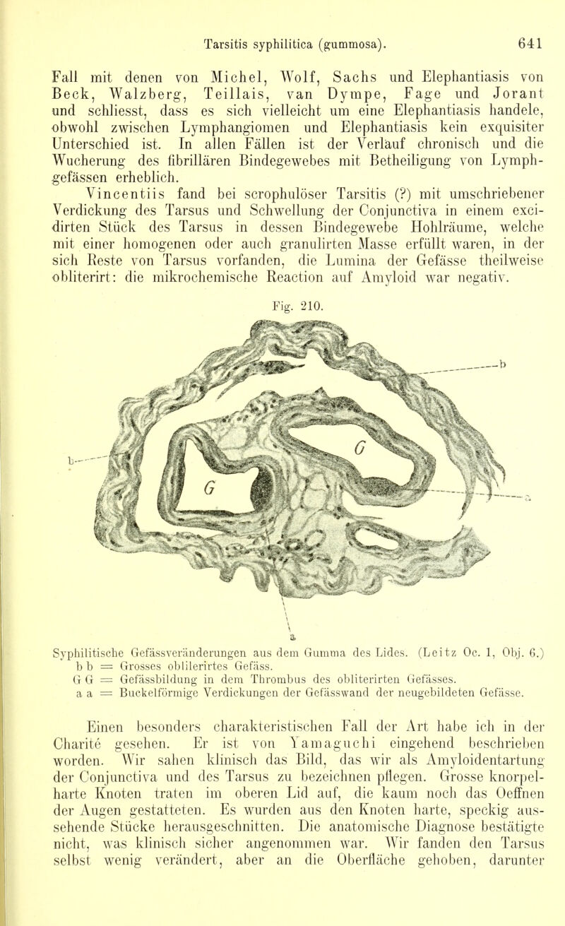 Fall mit denen von Michel, Wolf, Sachs und Elephantiasis von Beck, Walzberg, Teillais, van Dympe, Fage und Jorant und schliesst, dass es sich vielleicht um eine Elephantiasis handele, obwohl zwischen Lymphangiomen und Elephantiasis kein exquisiter Unterschied ist. In allen Fällen ist der Verlauf chronisch und die Wucherung des fibrillären Bindegewebes mit Betheiligung von Lymph- gefässen erheblich. Vincentiis fand bei scrophulöser Tarsitis (?) mit umschriebener Verdickung des Tarsus und Schwellung der Conjunctiva in einem exci- dirten Stück des Tarsus in dessen Bindegewebe Hohlräume, welche mit einer homogenen oder auch granulirten Masse erfüllt waren, in der sich Reste von Tarsus vorfanden, die Lumina der Gefässe theilweise obliterirt: die mikrochemische Reaction auf Amyloid war negativ. Fig. 210. & Syphilitische Gefässveränderungen aus dem Gumma des Lides. (Leitz Oc. 1, Obj. 6.) bb = Grosses oblilerirtes Gefäss. G G = Gefässbüdung in dem Thrombus des obliterirten Gefässes. a a = Buckelförmige Verdickungen der Gefässwand der neugebildeten Gefässe. Einen besonders charakteristischen Fall der Art habe ich in der Charite gesehen. Er ist von Yamaguchi eingehend beschrieben worden. Wir sahen klinisch das Bild, das wir als Amyloidentartung der Conjunctiva und des Tarsus zu bezeichnen pflegen. Grosse knorpel- harte Knoten traten im oberen Lid auf, die kaum noch das Oeffnen der Augen gestatteten. Es wurden aus den Knoten harte, speckig aus- sehende Stücke herausgeschnitten. Die anatomische Diagnose bestätigte nicht, was klinisch sicher angenommen war. Wir fanden dea Tarsus selbst wenig verändert, aber an die Oberfläche gehoben, darunter