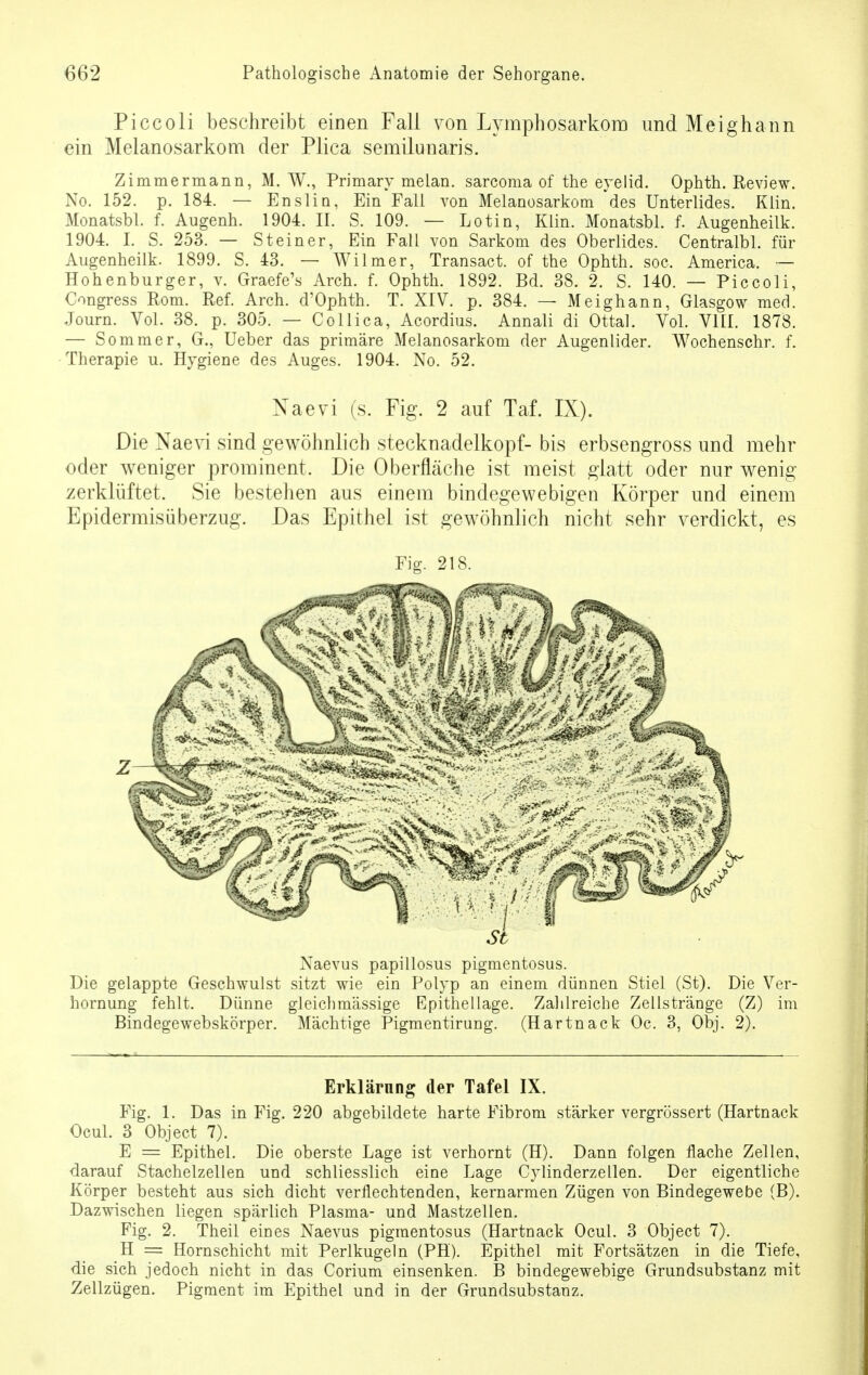 Piccoli beschreibt einen Fall von Lymphosarkom und Meighann ein Melanosarkom der Plica semilunaris. Zimmermann, M. W, Primary melan. sarcoma of the eyelid. Ophth. Review. No. 152. p. 184. — Enslin, Ein Fall von Melanosarkom 'des Unterlides. Klin. Monatsbl. f. Augenh. 1904. II. S. 109. — Lotin, Klin. Monatsbl. f. Augenheilk. 1904. I. S. 253. — Steiner, Ein Fall von Sarkom des Oberlides. Centralbl. für Augenheilk. 1899. S. 43. — Wilmer, Transact. of the Ophth. soc, America. — Hohenburger, v. Graefe's Arch. f. Ophth. 1892. Bd. 38. 2. S. 140. — Piccoli, Congress Rom. Ref. Arch. d'Ophth. T. XIV. p. 384. — Meighann, Glasgow med. Journ. Vol. 38. p. 305. — Collica, Acordius. Annali di Ottal. Vol. VIII. 1878. — Sommer, G., Ueber das primäre Melanosarkom der Augenlider. Wochenschr. f. Therapie u. Hygiene des Auges. 1904. No. 52. Naev-i (s. Fig. 2 auf Taf. IX). Die Naevi sind gewöhnlich Stecknadelkopf- bis erbsengross und mehr oder weniger prominent. Die Oberflache ist meist glatt oder nur wenig- zerklüftet. Sie bestehen aus einem bindegewebigen Körper und einem Epidermisiiberzug. Das Epithel ist gewöhnlich nicht sehr verdickt, es Fig. 218. Naevus papillosus pigmentosus. Die gelappte Geschwulst sitzt wie ein Polyp an einem dünnen Stiel (St). Die Ver- hornung fehlt. Dünne gleich massige Epithellage. Zahlreiche Zellstränge (Z) im Bindegewebskörper. Mächtige Pigmentirung. (Hartnack Oc. 3, Obj. 2). Erklärung der Tafel IX. Fig. 1. Das in Fig. 220 abgebildete harte Fibrom stärker vergrössert (Hartnack Ocul. 3 Object 7). E = Epithel. Die oberste Lage ist verhornt (H). Dann folgen flache Zellen, darauf Stachelzellen und schliesslich eine Lage Cylinderzellen. Der eigentliche Körper besteht aus sich dicht verflechtenden, kernarmen Zügen von Bindegewebe (B). Dazwischen liegen spärlich Plasma- und Mastzellen. Fig. 2. Theil eines Naevus pigmentosus (Hartnack Ocul. 3 Object 7). H = Hornschicht mit Perlkugeln (PH). Epithel mit Fortsätzen in die Tiefe, die sich jedoch nicht in das Corium einsenken. B bindegewebige Grundsubstanz mit Zellzügen. Pigment im Epithel und in der Grundsubstanz.