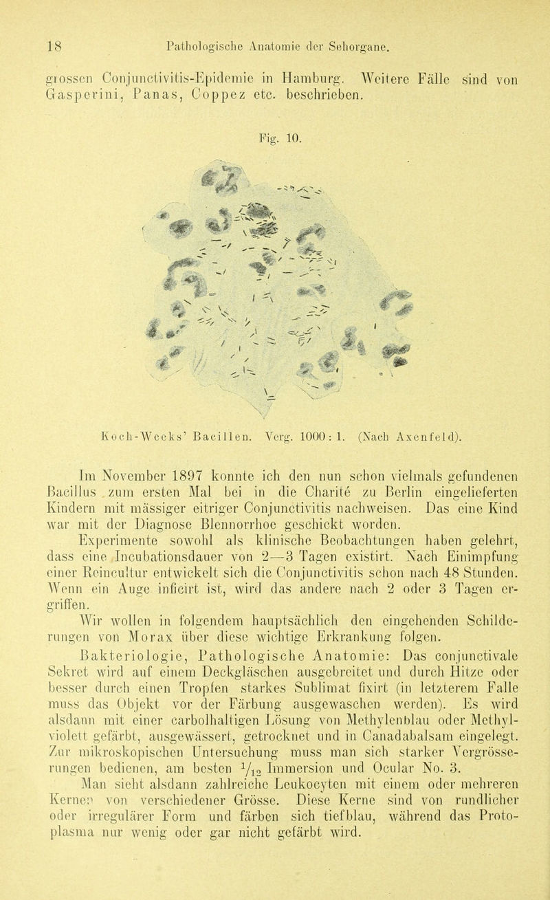 grossen Conjuiictivitis-Epidemie in Hamburg. Weitere Fälle sind von Gasperini, Panas, Coppez etc. beschrieben. Fig. 10. Koch-Weeks' Bacillen. Verg. 1000:1. (Nach Axenfeld). Im November 1897 konnte ich den nun schon vielmals gefundenen Bacillus zum ersten Mal bei in die Charite zu Berlin eingelieferten Kindern mit massiger eitriger Conjunctivitis nachweisen. Das eine Kind war mit der Diagnose Blennorrhoe geschickt worden. Experimente sowohl als klinische Beobachtungen haben gelehrt, dass eine Incubationsdauer von 2—3 Tagen existirt. Nach Einimpfung einer Reincultur entwickelt sich die Conjunctivitis schon nach 48 Stunden. Wenn ein Auge inficirt ist, wird das andere nach 2 oder 3 Tagen er- griffen. Wir wollen in folgendem hauptsächlich den eingehenden Schilde- rungen von Morax über diese wichtige Erkrankung folgen. Bakteriologie, Pathologische Anatomie: Das conjunctivale Sekret wird auf einem Deckgläschen ausgebreitet und durch Hitze oder besser durch einen Tropfen starkes Sublimat fixirt (in letzterem Falle muss das Objekt vor der Färbung ausgewaschen werden). Es wird alsdann mit einer carbolhaltigen Lösung von Methylenblau oder Methyl- violett gefärbt, ausgewässert, getrocknet und in Canadabalsam eingelegt. Zur mikroskopischen Untersuchung muss man sich starker Vergrösse- rungen bedienen, am besten Y12 Immersion und Ocular No. 3. Man sieht alsdann zahlreiche Leukocyten mit einem oder mehreren Kernen von verschiedener Grösse. Diese Kerne sind von rundlicher oder irregulärer Form und färben sich tiefblau, während das Proto- plasma nur wenig oder gar nicht gefärbt wird.