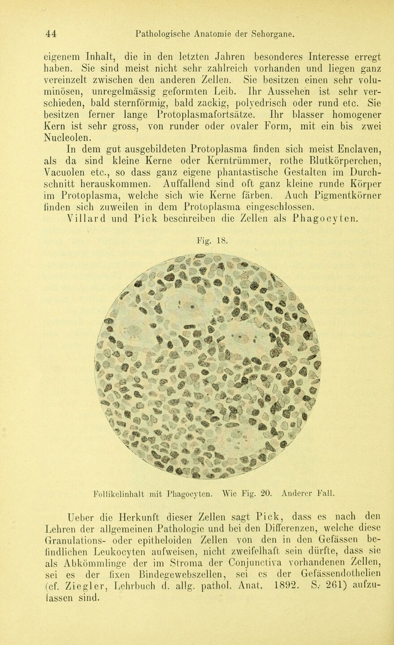 eigenem Inhalt, die in den letzten Jahren besonderes Interesse erregt haben. Sie sind meist nicht sehr zahlreich vorhanden und liegen ganz vereinzelt zwischen den anderen Zellen. Sie besitzen einen sehr volu- minösen, unregelmässig geformten Leib. Ihr Aussehen ist sehr ver- schieden, bald sternförmig, bald zackig, polyedrisch oder rund etc. Sie besitzen ferner lange Protoplasmafortsätze. Ihr blasser homogener Kern ist sehr gross, von runder oder ovaler Form, mit ein bis zwei Nucleolen. In dem gut ausgebildeten Protoplasma finden sich meist Enclaven, als da sind kleine Kerne oder Kerntrümmer, rothe Blutkörperchen, Vacuolen etc., so dass ganz eigene phantastische Gestalten im Durch- schnitt herauskommen. Auffallend sind oft ganz kleine runde Körper im Protoplasma, welche sich wie Kerne färben. Auch Pigraentkörner finden sich zuweilen in dem Protoplasma eingeschlossen. Villard und Pick beschreiben die Zellen als Phagocyten. Fig. 18. % 4 ^'^ 4 ^ Follikelinhalt mit Phagocyten. Wie Fig. 20. Anderer Fall, lieber die Herkunft dieser Zellen sagt Pick, dass es nach den Lehren der allgemeinen Pathologie und bei den Differenzen, welche diese Granulations- oder epitheloiden Zellen von den in den Gefässen be- findlichen Leukocyten aufweisen, nicht zweifelhaft sein dürfte, dass sie als Abkömmlinge der im Stroma der Conjunctiva vorhandenen Zellen, sei es der fixen ßindeaewebszellen, sei es der Gefässendothelien (cf. Ziegler, Lehrbuch d. allg. pathol. Anat. 1892. S.- 261) aufzu- fassen sind.