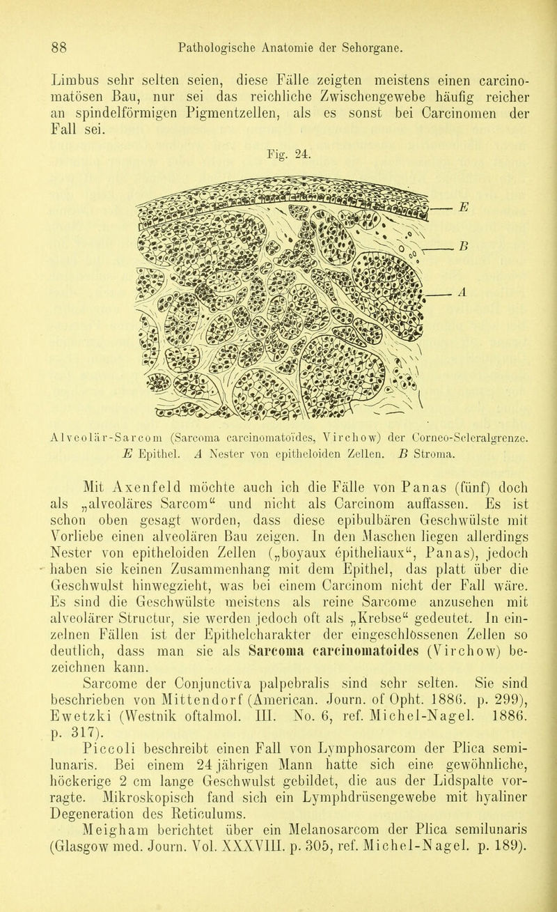 Limbus sehr selten seien, diese Fälle zeigten meistens einen carcino- matösen Bau, nur sei das reichliche Zwischengewebe häufig reicher an spindelförmigen Pigmentzellen, als es sonst bei Carcinomen der Fall sei. Fig. 24. Alveolär-Sarcom (Sarcoma carcinomatoides, Virchow) der Corneo-Scleralgrenze. E Epithel. A Nester von epitheloiden Zellen. B Stroma. Mit Axenfeld möchte auch ich die Fälle von Panas (fünf) doch als „alveoläres Sarcom und nicht als Carcinom auffassen. Es ist schon oben gesagt worden, dass diese epibulbären Geschwülste mit Vorliebe einen alveolären Bau zeigen. In den Maschen liegen allerdings Nester von epitheloiden Zellen („boyaux epitheliaux, Panas), jedoch haben sie keinen Zusammenhang mit dem Epithel, das platt über die Geschwulst hinwegzieht, was bei einem Carcinom nicht der Fall wäre. Es sind die Geschwülste meistens als reine Sarcome anzusehen mit alveolärer Structur, sie werden jedoch oft als „Krebse gedeutet. In ein- zelnen Fällen ist der Epithelcharakter der eingeschlossenen Zellen so deutlich, dass man sie als Sarcoma carcinomatoides (Zirchow) be- zeichnen kann. Sarcome der Conjunctiva palpebralis sind sehr selten. Sie sind beschrieben von Mittendorf (American. Journ. of Opht. 1886. p. 299), Ewetzki (Westnik oftalmol. III. No. 6, ref. Michel-Nagel. 1886. p. 317). Piccoli beschreibt einen Fall von Lymphosarcom der Plica semi- lunaris. Bei einem 24 jährigen Mann hatte sich eine gewöhnliche, höckerige 2 cm lange Geschwulst gebildet, die aus der Lidspalte vor- ragte. Mikroskopisch fand sich ein Lymphdrüsengewebe mit hyaliner Degeneration des Reticulums. Meigham berichtet über ein Melanosarcom der Plica semilunaris (Glasgow med. Journ. Vol. XXXVIIL p. 305, ref. Michel-Nagel, p. 189).