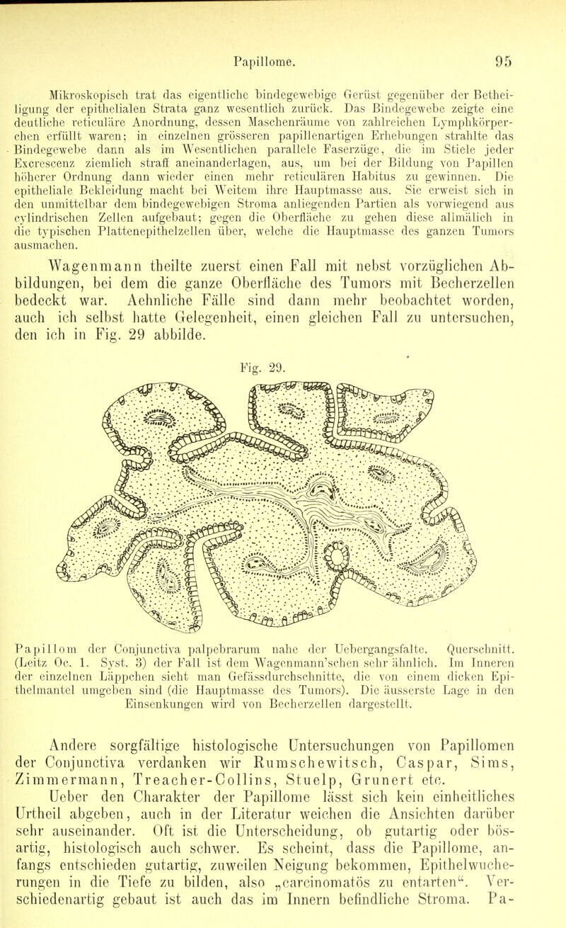 Mikroskopisch trat das eigentliche bindegewebige Gerüst gegenüber der Bethei- ligung der epithelialen Strata ganz wesentlich zurück. Das Bindegewebe zeigte eine deutliche reticuläre Anordnung, dessen Maschenräume von zahlreichen Lymphkörper- chen erfüllt waren; in einzelnen grösseren papillenartigen Erhebungen strahlte das Bindegewebe dann als im Wesentlichen parallele Faserzüge, die im Stiele jeder Excrescenz ziemlich straff aneinanderlagen, aus, um bei der Bildung von Papillen höherer Ordnung dann wieder einen mehr reticulären Habitus zu gewinnen. Die epitheliale Bekleidung macht bei Weitem ihre Hauptmasse aus. Sie erweist sich in den unmittelbar dem bindegewebigen Stroma anliegenden Partien als vorwiegend aus cylindrischen Zellen aufgebaut; gegen die Oberfläche zu gehen diese allmälich in die typischen Plattenepithelzellen über, welche die Hauptmasse des ganzen Tumors ausmachen. Wag eil mann th eilte zuerst einen Fall nait nebst vorzüglichen Ab- bildungen, bei dem die ganze Oberfläche des Tumors mit Becherzellen bedeckt war. Aehnliche Fälle sind dann mehr beobachtet worden, auch ich selbst hatte Gelegenheit, einen gleichen Fall zu untersuchen, den ich in Fig. 29 abbilde. Fig. 29. Pai^illom der Conjunctiva palpebrarum nahe der Uebergangsfalte. Querschnitt. (Leitz Oc. 1. Syst. 3) der Fall ist dem Wagonmann'schen sehr ähnlich. Im Inneren der einzelnen Läppchen sieht man Gefässdurchschnitte, die von einem dicken Epi- thelmantel umgeben sind (die Hauptmasse des Tumors). Die äusserste Lage in den Einsenkungen wird von Becherzellen dargestellt. Andere sorgfältige histologische Untersuchungen von Papillomen der Conjunctiva verdanken wir Rumschewitsch, Caspar, Sims, Zimmermann, Treacher-Collins, Stuelp, Grunert etc. üeber den Charakter der Papillome lässt sich kein einheitliches ürtheil abgeben, auch in der Literatur weichen die Ansichten darüber sehr auseinander. Oft ist die Unterscheidung, ob gutartig oder bös- artig, histologisch auch schwer. Es scheint, dass die Papillome, an- fangs entschieden gutartig, zuweilen Neigung bekommen, Epithelwuche- rungen in die Tiefe zu bilden, also „carcinomatös zu entarten. Ver- schiedenartig gebaut ist auch das im Innern befindliche Stroma. Pa-