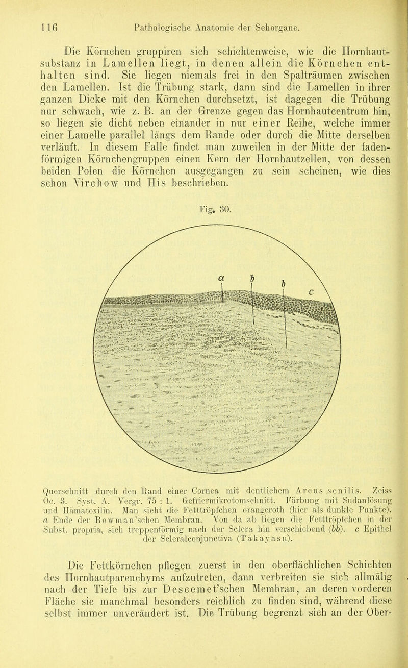 Die Körnchen gruppiren sich schichtenweise, wie die Hornhaut- siibstanz in Lamellen liegt, in denen allein die Körnchen ent- halten sind. Sie liegen nienaals frei in den Spalträumen zwischen den Lamellen. Ist die Trübung stark, dann sind die Laraellen in ihrer ganzen Dicke mit den Körnchen durchsetzt, ist dagegen die Trübung nur schwach, wie z. B. an der Grenze gegen das Hornhautcentrum hin, so liegen sie dicht neben einander in nur einer Eeihe, welche immer einer Lamelle parallel längs dem Rande oder durch die Mitte derselben verläuft. In diesem Falle findet man zuweilen in der Mitte der faden- förmigen Körnchengruppen einen Kern der Hornhautzellen, von dessen beiden Polen die Körnchen ausgegangen zu sein scheinen, wie dies schon Virchow und His beschrieben. Fig. 30. Querschnitt durch den Rand einer Cornea mit deutlichem Arcus senilis. Zeiss Oc. 3. Syst. A. Vergr. 75 : 1. Gefriermikrotomschnitt. Färbung mit Sudanlösung und Hämatoxilin. Man sieht die Fetttröpfchen orangeroth (hier als dunkle Punkte). a Ende der Bowman'schen Membran. Von da ab liegen die Fetttröpfchen in der Subst. propria, sich treppenförmig nach der Sclera hin verschiebend (hh). c Epithel der Scleralconjunctiva (Takayasu). Die Fettkörnchen pflegen zuerst in den oberflächlichen Schichten des Hornhautparenchyms aufzutreten, dann verbreiten sie sich allmälig nach der Tiefe bis zur Descemet'schen Membran, an deren vorderen Fläche sie manchmal besonders reichlich zu finden sind, während diese selbst immer unverändert ist. Die Trübung begrenzt sich an der Ober-