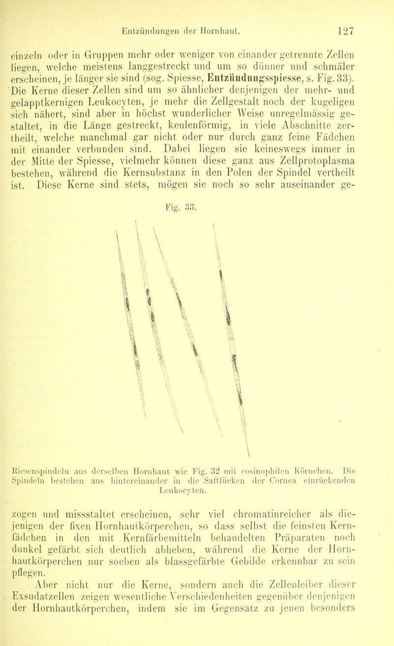 einzeln oder in Gruppen mehr oder weniger von einander getrennte Zellen liegen, welche meistens langgestreckt und um so dünner und schmäler erscheinen, je Länger sie sind (sog. Spiesse, Entziiiidinigsspiesse, s. Fig. 33). Die Kerne dieser Zellen sind um so ähnlicher denjenigen der mehr- und gelapptkernigen Leukocyten, je mehr die Zellgestalt noch der kugeligen sich nähert, sind aber in höchst wunderlicher Weise unregelmässig ge- staltet, in die Länge gestreckt, keulenförmig, in viele Abschnitte zer- llicilt, welche manchmal gar nicht oder nur durch ganz feine Fädchen mit einander verbunden sind. Dabei liegen sie keineswegs immer in der Mitte der Spiesse, vielmehr können diese ganz aus Zellprotoplasma bestehen, während die Kernsubstanz in den Polen der Spindel vertheilt ist. Diese Kerne sind stets, mögen sie noch so sehr auseinander ge- Fig. 33. tvicsL-nspiridcln aus derselben Hornhaut wie Fig. 32 mit eosinophilen Körnchen. Die Spindi'ln bestehen aus hintereinander in die Saftlücken der Cornea einrüclvcnden Leukocyten. zogen und missstaltet erscheinen, sehr viel chromatinreicher als die- jenigen der fixen Hornhautkörperchen, so dass selbst die feinsten Kern- ladchcn in den mit Kernfärbemitteln behandelten Präparaten noch dunkel gefärbt sich deutlich abheben, während die Kerne der Horn- hautkörperchen nur soeben als blassgefärbte Gebilde erkennbar zu sein pllegen. Aber nicht nur die Kerne, sondern auch die Zellenleiber dieser Exsudatzellen zeigen wesentliche Verschiedenheiten gegenüber denjenigen der Hornhautkörperchen, indem sie im Gegensatz zu jenen besonders