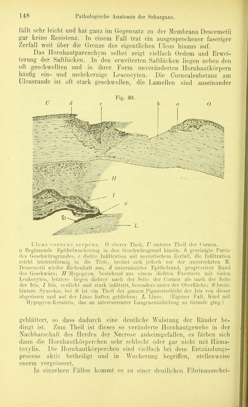 fällt sehr leicht und hat ganz im Gegensatz zu der Membrana Descemetii gar keine Resistenz. In einem Fall trat ein ausgesprochener faseriger Zerfall weit über die Grenze des eigentlichen Ulcus hinaus auf. Das Hornhautparenchym selbst zeigt vielfach Oedem und Erwei- terung der Saftlücken. In den erweiterten Saftlücken liegen neben den oft geschwellten und in ihrer Form unveränderten Hornhautkörpern häufig ein- und mehrkernige Leucocyten. Die Oornealsubstanz am Ulcusrande ist oft stark geschwollen, die Lamellen sind auseinander Fig. 40. TJ d c h a 0 Ulcus'Corneae_ seriDens. 0 oberer Theil, ?7 unterer Theil der Cornea. a Beginnende Epithelwucherung in den Geschwürsgrund hinein, ö gereinigte Partie des Geschwürsgrundes, c dichte Inültration mit necrotischem Zerfall, die Infiltration reicht trichterförmig in die Tiefe, breitet sich jedoch vor der unversehrten M. Descemetii wieder flächenhaft aus, d unterminirter Epithelrand, progressiver Rand des Geschwürs; H Hypopyon, bestehend aus einem dichten Fasernetz mit vielen Leukocyten, letztere liegen dichter nach der Seite der Cornea als nach der Seite der Iris, J Iris, verdickt und stark infiltrirt, besonders unter der Oberfläche; /S'breite hintere Synechie, bei S ist ein Theil der ganzen Pigmentschicht der Iris von dieser abgerissen und auf der Linse haften geblieben; L Linse. (Eigener Fall, Kind mit Hypopyon-Keratitis, das an intercurrenter Lungenentzündung zu Grunde ging.) geblättert, so dass dadurch eine deutliche Wulstung der Ränder be- dingt ist. Zum Theil ist dieses so veränderte Hornhautgewebe in der Nachbarschaft des Herdes der Necrose anheimgefallen, es färben sich dann die Hornhautkörperchen sehr schlecht oder gar nicht mit Häma- toxylin. Die Hornhautkörperchen sind vielfach bei dem Entzündungs- process aktiv betheiligt und in Wucherung begriffen, stellenweise enorm vergrössert. In einzelnen Fällen kommt es zu einer deutlichen Fibrinausschei-