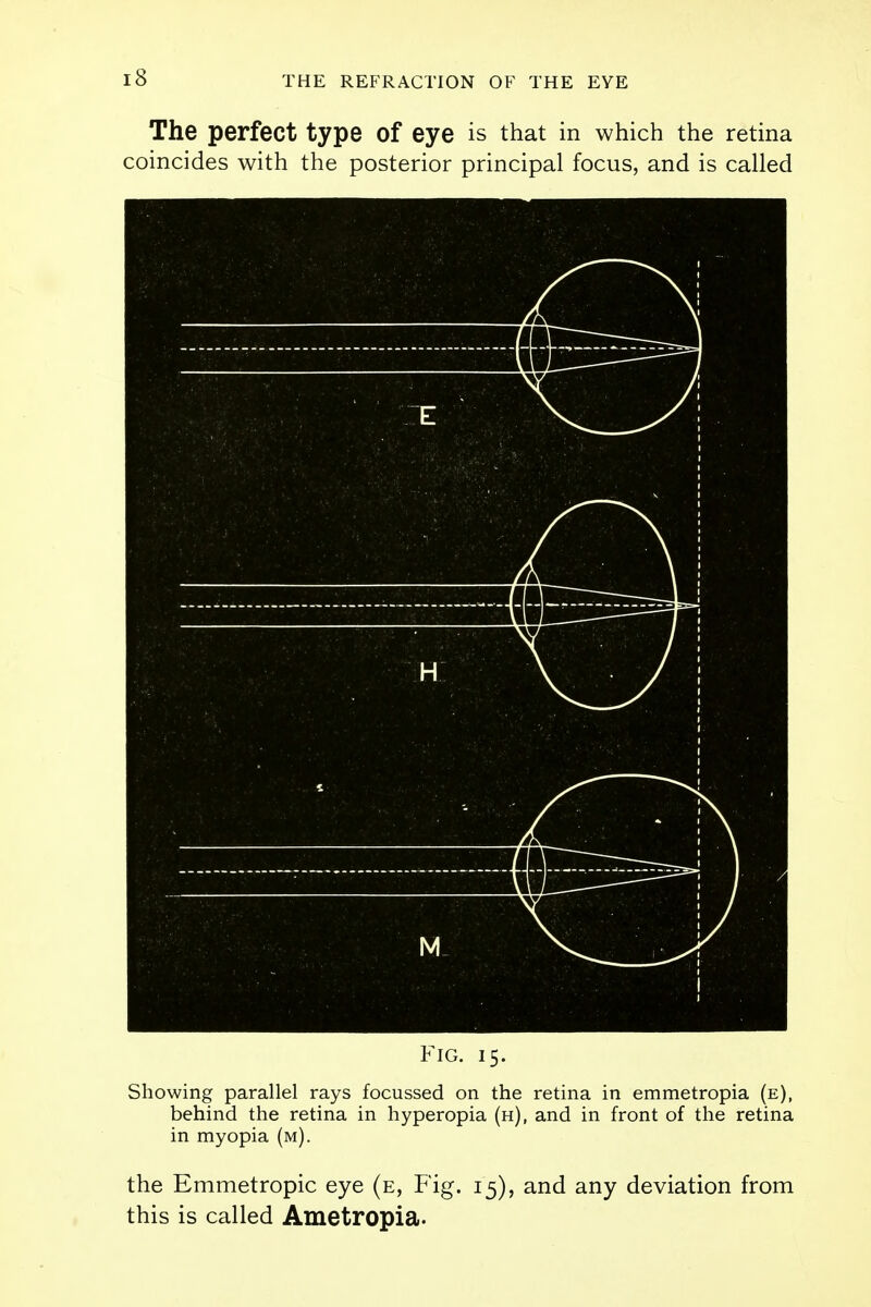 The perfect type of eye is that in which the retina coincides with the posterior principal focus, and is called Fig. 15. Showing parallel rays focussed on the retina in emmetropia (e), behind the retina in hyperopia (h), and in front of the retina in myopia (m). the Emmetropic eye (e, Fig. 15), and any deviation from this is called Ametropia.