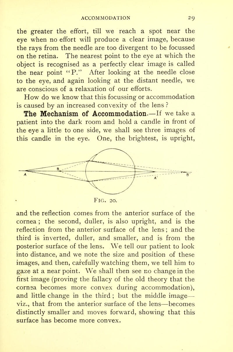 the greater the effort, till we reach a spot near the eye when no effort will produce a clear image, because the rays from the needle are too divergent to be focussed on the retina. The nearest point to the eye at which the object is recognised as a perfectly clear image is called the near point P. After looking at the needle close to the eye, and again looking at the distant needle, we are conscious of a relaxation of our efforts. How do we know that this focussing or accommodation is caused by an increased convexity of the lens ? The Mechanism of Accommodation.—If we take a patient into the dark room and hold a candle in front of the eye a little to one side, we shall see three images of this candle in the eye. One, the brightest, is upright, Fig. 20. and the reflection comes from the anterior surface of the cornea ; the second, duller, is also upright, and is the reflection from the anterior surface of the lens; and the third is inverted, duller, and smaller, and is from the posterior surface of the lens. We tell our patient to look into distance, and we note the size and position of these images, and then, carefully watching them, we tell him to gaze at a near point. We shall then see no change in the first image (proving the fallacy of the old theory that the cornsa becomes more convex during accommodation), and little change in the third ; but the middle image— viz., that from the anterior surface of the lens—becomes distinctly smaller and moves forward, showing that this surface has become more convex.