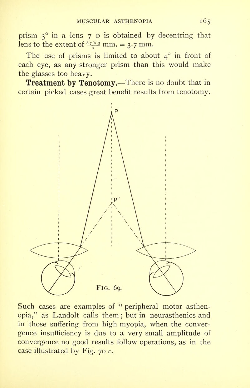 prism 30 in a lens 7 d is obtained by decentring that lens to the extent of 8-7-^ mm. = 3.7 mm. The use of prisms is limited to about 40 in front of each eye, as any stronger prism than this would make the glasses too heavy. Treatment by Tenotomy.—There is no doubt that in certain picked cases great benefit results from tenotomy. Such cases are examples of  peripheral motor asthen- opia, as Landolt calls them; but in neurasthenics and in those suffering from high myopia, when the conver- gence insufficiency is due to a very small amplitude of convergence no good results follow operations, as in the case illustrated by Fig. 70 c.