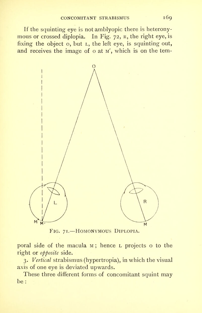 If the squinting eye is not amblyopic there is heterony- mous or crossed diplopia. In Fig. 72, r, the right eye, is fixing the object o, but l, the left eye, is squinting out, and receives the image of o at m', which is on the tem- 0 Fig. 71.—Homonymous Diplopia. poral side of the macula M ; hence l projects o to the right or opposite side. 3. Vertical strabismus (hypertropia), in which the visual axis of one eye is deviated upwards. These three different forms of concomitant squint may be: