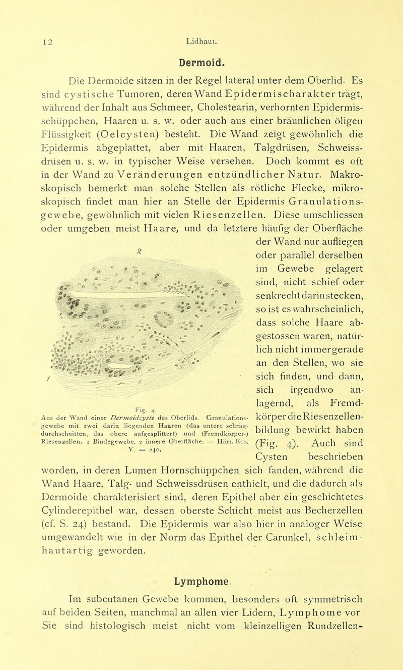 Dermoid. Die Dermoide sitzen in der Regel lateral unter dem Oberlid. Es sind cystische Tumoren, deren Wand Epidermischarakter trägt, während der Inhalt aus Schmeer, Cholestearin, verhornten Epidermis- schüppchen, Haaren u. s. w. oder auch aus einer bräunlichen öligen Flüssigkeit (OelCysten) besteht. Die Wand zeigt gewöhnlich die Epidermis abgeplattet, aber mit Haaren, Talgdrüsen, Schweiss- drüsen u. s. w. in typischer Weise versehen. Doch kommt es oft in der Wand zu Veränderungen entzündlicher Natur. Makro- skopisch bemerkt man solche Stellen als rötliche Flecke, mikro- skopisch findet man hier an Stelle der Epidermis Granulations- gewebe, gewöhnlich mit vielen Riesenzellen. Diese umschliessen oder umgeben meist Haare, und da letztere häufig der Oberfläche der Wand nur aufliegen oder parallel derselben <%, 1 - % im Gewebe gelagert ° • ' • • . ö* sind, nicht schief oder • 4' * • senkrechtdarinstecken, .*■ j? % ** , °5* so ist es wahrscheinlich, i f ^/ .. V '• . dass solche Haare ab- t , - «, V'- • * • gestossen waren, natür- ; r . ■ ■ ' 1 lieh nicht immergerade *-;|>;:^ ' . .. ' *' an den Stellen, wo sie i ' sich finden, und dann, sich irgendwo an- lagernd, als Fremd- Fig. 4. . . Aus der Wand einer Dermoidcyste des Oberlids. Granulations- kÖrper die Riesenzellen- gewebe mit zwei darin liegenden Haaren (das untere schräg- , • , , , • i , i i durchschnitten, das obere aufgesplittert) und (Fremdkörper-) blldung bewirkt haben Riesenzellen, r Bindegewebe, 2 innere Oberfläche. — Häm. Eos. (pjg 4) Audi sind Cysten beschrieben worden, in deren Lumen Hornschüppchen sich fanden, während die Wand Haare, Talg- und Schweissdrüsen enthielt, und die dadurch als Dermoide charakterisiert sind, deren Epithel aber ein geschichtetes Cylinderepithel war, dessen oberste Schicht meist aus Becherzellen (cf. S. 24) bestand. Die Epidermis war also hier in analoger Weise umgewandelt wie in der Norm das Epithel der Carunkel, schleim- hautartig geworden. Lymphome. Im subcutanen Gewebe kommen, besonders oft symmetrisch auf beiden Seiten, manchmal an allen vier Lidern, Lymphome vor Sie sind histologisch meist nicht vom kleinzelligen Rundzellen-