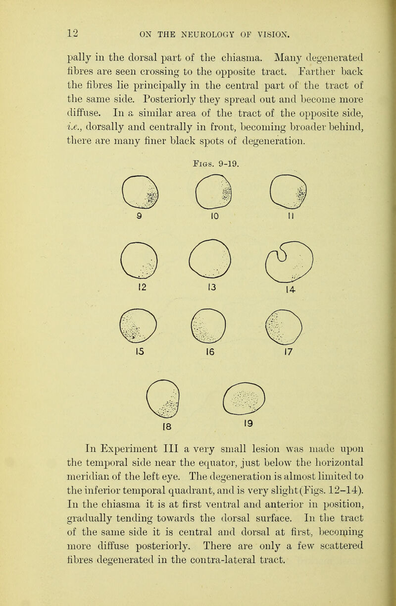 pally in the dorsal part of the chiasma. Many degenerated fibres are seen crossing to the opposite tract. Farther back the fibres lie principally in the central part of the tract of the same side. Posteriorly they spread out and become more diffuse. In a similar area of the tract of the opposite side, i.e., dorsally and centrally in front, becoming broader behind, there are many finer black spots of degeneration. Figs. 9-19. 9 10 II 15 16 17 18 '9 In Experiment III a very small lesion was made upon the temporal side near the equator, just below the horizontal meridian of the left eye. The degeneration is almost limited to the inferior temporal quadrant, and is very slight (Figs. 12-14). In the chiasma it is at first ventral and anterior in position, gradually tending towards the dorsal surface. In the tract of the same side it is central and dorsal at first, becoming more diffuse posteriorly. There are only a few scattered fibres degenerated in the contra-lateral tract.