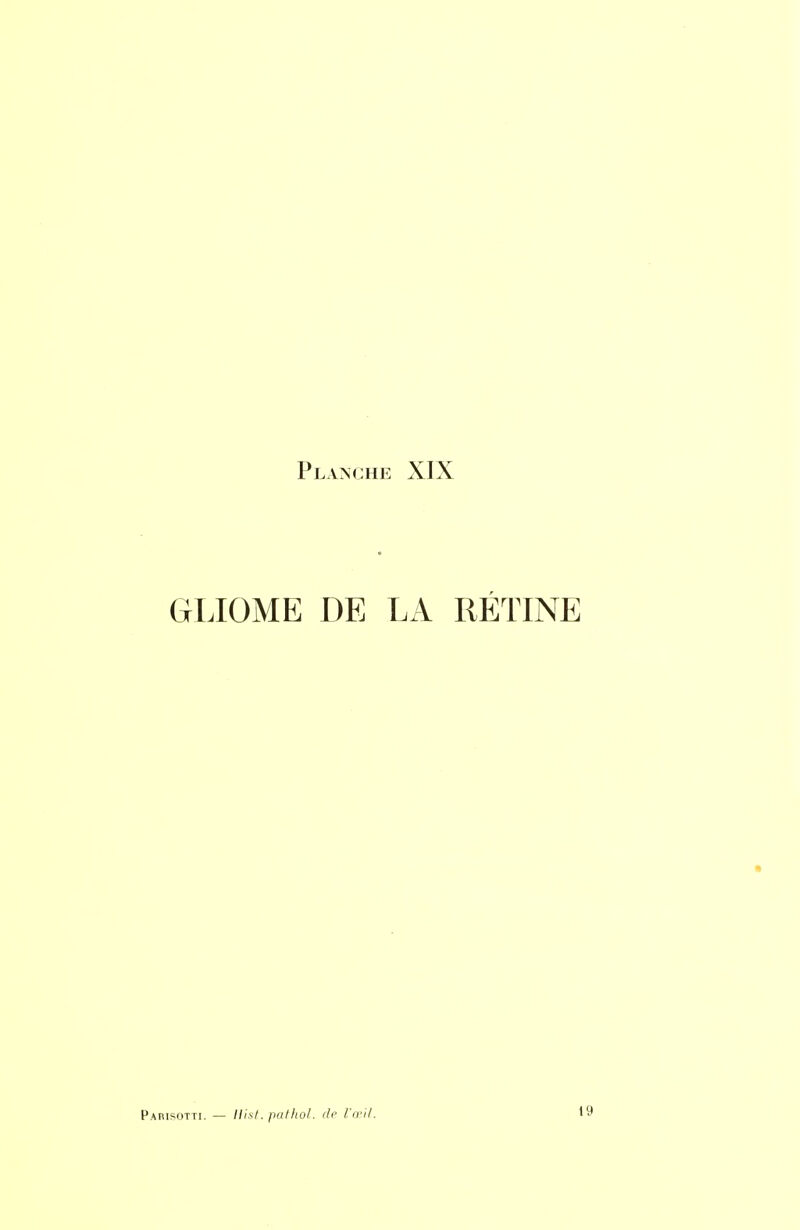 GLIOME DE LA RÉTINE Pabisotti. — llisl. pafliol. dr /.'(ri/. 19
