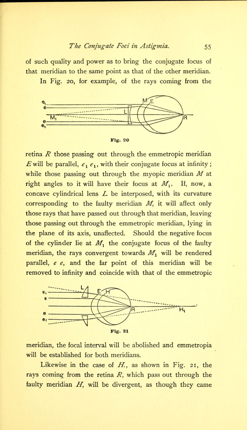 of such quality and power as to bring the conjugate focus of that meridian to the same point as that of the other meridian. In Fig. 20, for example, of the rays coming from the Fig. SO retina R those passing out through the emmetropic meridian is will be parallel, e1 elt with their conjugate focus at infinity ; while those passing out through the myopic meridian M at right angles to it will have their focus at Mv. If, now, a concave cylindrical lens L be interposed, with its curvature corresponding to the faulty meridian M, it will affect only those rays that have passed out through that meridian, leaving those passing out through the emmetropic meridian, lying in the plane of its axis, unaffected. Should the negative focus of the cylinder lie at Mx the conjugate focus of the faulty meridian, the rays convergent towards Mx will be rendered parallel, e e, and the far point of this meridian will be removed to infinity and coincide with that of the emmetropic Fig. 21 meridian, the focal interval will be abolished and emmetropia will be established for both meridians. Likewise in the case of H., as shown in Fig. 21, the rays coming from the retina R, which pass out through the faulty meridian H, will be divergent, as though they came