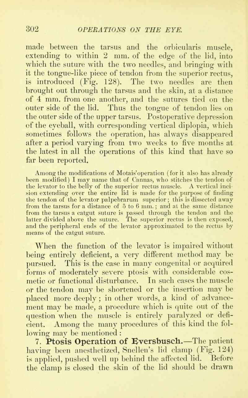 made between the tarsus and the orbicularis muscle, extending to within 2 mm. of the edge of the lid, into which the suture with the two needles, and bringing with it the tongue-like piece of tendon from the superior rectus, is introduced (Fig. 128). The two needles are then brought out through the tarsus and the skin, at a distance of 4 mm. from one another, and the sutures tied on the outer side of the lid. Thus the tongue of tendon lies on the outer side of the upper tarsus. Postoperative depression of the eyeball, with corresponding vertical diplopia, which sometimes follows the operation, has always disappeared after a period varying from two weeks to five months at the latest in all the operations of this kind that have so far been reported. Among the modifications of Motais'operation (for it also has already been modified) I may name that of Cannas, who stitches the tendon of the levator to the belly of the superior rectus muscle. A vertical inci- sion extending over the entire lid is made for the purpose of finding the tendon of the levator palpebrarum superior; this is dissected away from the tarsus for a distance of 5 to 6 mm.; and at the same distance from the tarsus a catgut suture is passed through the tendon and the latter divided above the suture. The superior rectus is then exposed, and the peripheral ends of the levator approximated to the rectus by means of the catgut suture. When the function of the levator is impaired without being entirely deficient, a very different method may be pursued. This is the case in many congenital or acquired forms of moderately severe ptosis with considerable cos- metic or functional disturbance. In such cases the muscle or the tendon may be shortened or the insertion may be placed more deeply; in other words, a kind of advance- ment may be made, a procedure which is quite out of the question when the muscle is entirely paralyzed or defi- cient. Among the many procedures of this kind the fol- lowing may be mentioned : 7. Ptosis Operation of Eversbusch.—The patient having been anesthetized, Snellen's lid clamp (Fig. 124) is applied, pushed well up behind the affected lid. Before the clamp is closed the skin of the lid should be drawn