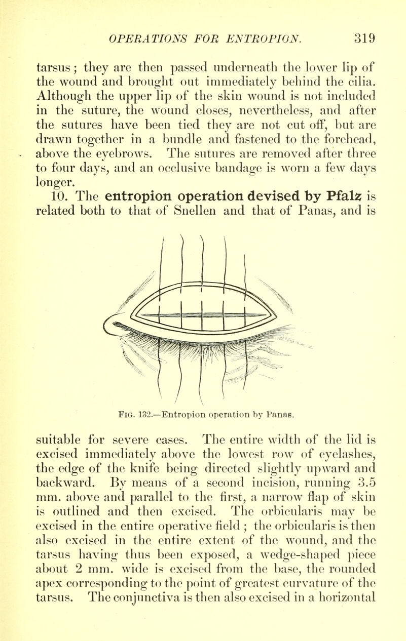 tarsus; they are then passed underneath the lower lip of the wound and brought out immediately behind the cilia. Although the upper lip of the skin wound is not included in the suture, the wound closes, nevertheless, and after the sutures have been tied they are not cut off, but are drawn together in a bundle and fastened to the forehead, above the eyebrows. The sutures are removed after three to four days, and an occlusive bandage is worn a few days longer. 10. The entropion operation devised by Pfals is related both to that of Snellen and that of Panas, and is suitable for severe cases. The entire width of the lid is excised immediately above the lowest row of eyelashes, the edge of the knife being directed slightly upward and backward. By means of a second incision, running 3.5 mm. above and parallel to the first, a narrow flap of skin is outlined and then excised. The orbicularis may be excised in the entire operative field ; the orbicularis is then also excised in the entire extent of the wound, and the tarsus having thus been exposed, a wedge-shaped piece about 2 mm. wide is excised from the base, the rounded apex corresponding to the point of greatest curvature of the tarsus. The conjunctiva is then also excised in a horizontal