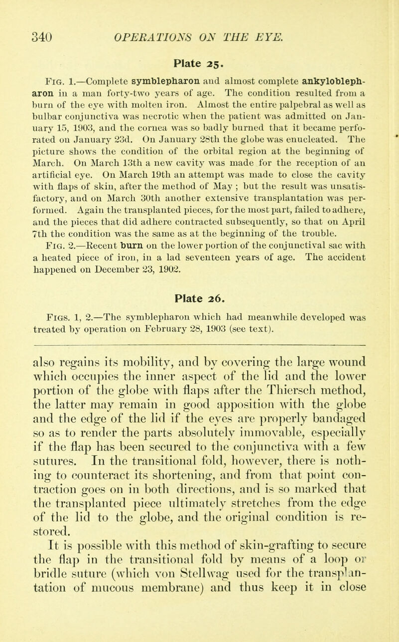 Plate 25. Fig. 1.—Complete symblepharon and almost complete ankylobleph- aron in a man forty-two years of age. The condition resulted from a burn of the eye with molten iron. Almost the entire palpebral as well as bulbar conjunctiva was necrotic when the patient was admitted on Jan- uary 15, 1903, and the cornea was so badly burned that it became perfo- rated on January 23d. On January 28th the globe was enucleated. The picture shows the condition of the orbital region at the beginning of March. On March 13th a new cavity was made for the reception of an artificial eye. On March 19th an attempt was made to close the cavity with flaps of skin, after the method of May ; but the result was unsatis- factory, and on March 30th another extensive transplantation was per- formed. Again the transplanted pieces, for the most part, failed to adhere, and the pieces that did adhere contracted subsequently, so that on April 7th the condition was the same as at the beginning of the trouble. Fig. 2.—Eecent burn on the lower portion of the conjunctival sac with a heated piece of iron, in a lad seventeen years of age. The accident happened on December 23, 1902. Plate 26. Figs. 1, 2.—The symblepharon which had meanwhile developed was treated by operation on February 28, 1903 (see text). also regains its mobility, and by covering the large wound which occupies the inner aspect of the lid and the lower portion of the globe with flaps after the Thiersch method, the latter may remain in good apposition with the globe and the edge of the lid if the eyes are properly bandaged so as to render the parts absolutely immovable, especially if the flap has been secured to the conjunctiva with a few sutures. In the transitional fold, however, there is noth- ing to counteract its shortening, and from that point con- traction goes on in both directions, and is so marked that the transplanted piece ultimately stretches from the edge of the lid to the globe, and the original condition is re- stored. It is possible with this method of skin-grafting to secure the flap in the transitional fold by means of a loop or bridle suture (which von Stellwag used for the transplan- tation of mucous membrane) and thus keep it in close