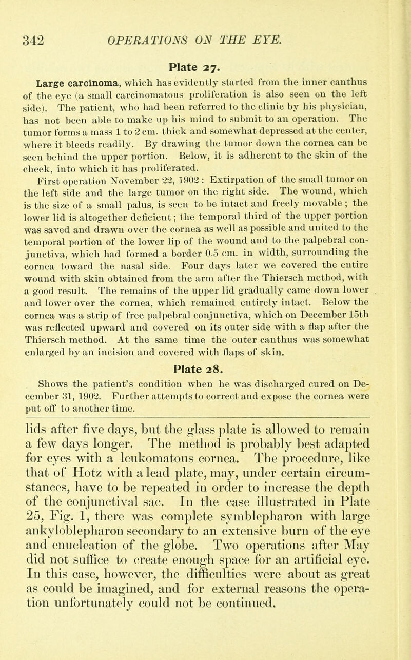Plate 27. Large carcinoma, which has evidently started from the inner canthus of the eye (a small carcinomatous proliferation is also seen on the left side). The patient, who had been referred to the clinic by his physician, has not been able to make up his mind to submit to an operation. The tumor forms a mass 1 to 2 cm. thick and somewhat depressed at the center, where it bleeds readily. By drawing the tumor down the cornea can be seen behind the upper portion. Below, it is adherent to the skin of the cheek, into which it has proliferated. First operation November 22, 1902 : Extirpation of the small tumor on the left side and the large tumor on the right side. The wound, which is the size of a small palus, is seen to be intact and freely movable ; the lower lid is altogether deficient; the temporal third of the upper portion was saved and drawn over the cornea as well as possible and united to the temporal portion of the lower lip of the wound and to the palpebral con- junctiva, which had formed a border 0.5 cm. in width, surrounding the cornea toward the nasal side. Four days later we covered the entire wound with skin obtained from the arm after the Thiersch method, with a good result. The remains of the upper lid gradually came down lower and lower over the cornea, which remained entirely intact. Below the cornea was a strip of free palpebral conjunctiva, which on December 15th was reflected upward and covered on its outer side with a flap after the Thiersch method. At the same time the outer canthus was somewhat enlarged by an incision and covered with flaps of skin. Plate 28. Shows the patient's condition wheu he was discharged cured on De- cember 31, 1902. Further attempts to correct and expose the cornea were put off to another time. lids after five days, but the glass plate is allowed to remain a few days longer. The method is probably best adapted for eyes with a leukomatous cornea. The procedure, like that of Hotz with a lead plate, may, under certain circum- stances, have to be repeated in order to increase the depth of the conjunctival sac. In the case illustrated in Plate 25, Fig. 1, there was complete symblepharon with large ankyloblepharon secondary to an extensive burn of the eye and enucleation of the globe. Two operations after May did not suffice to create enough space for an artificial eye. In this case, however, the difficulties were about as great as could be imagined, and for external reasons the opera- tion unfortunately could not be continued.