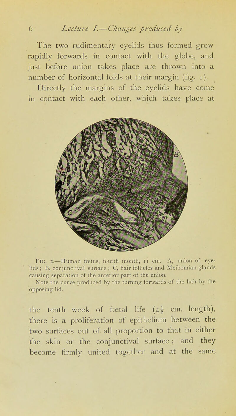 The two rudimentary eyelids thus formed grow rapidly forwards in contact with the globe, and just before union takes place are thrown into a number of horizontal folds at their margin (fig. i ). Directly the margins of the eyelids have come in contact with each other, which takes place at Fig. 2.—Human fetus, fourth month, 11 cm. A, union of eye- hds ; B, conjunctival surface ; C, hair foUicles and Meibomian glands causing separation of the anterior part of the union. Note the curve produced by the turning forwards of the hair by the opposing lid. the tenth week of fcetal life (4^ cm. length), there is a proliferation of epithelium between the two surfaces out of all proportion to that in either the skin or the conjunctival surface ; and they become firmly united together and at the same