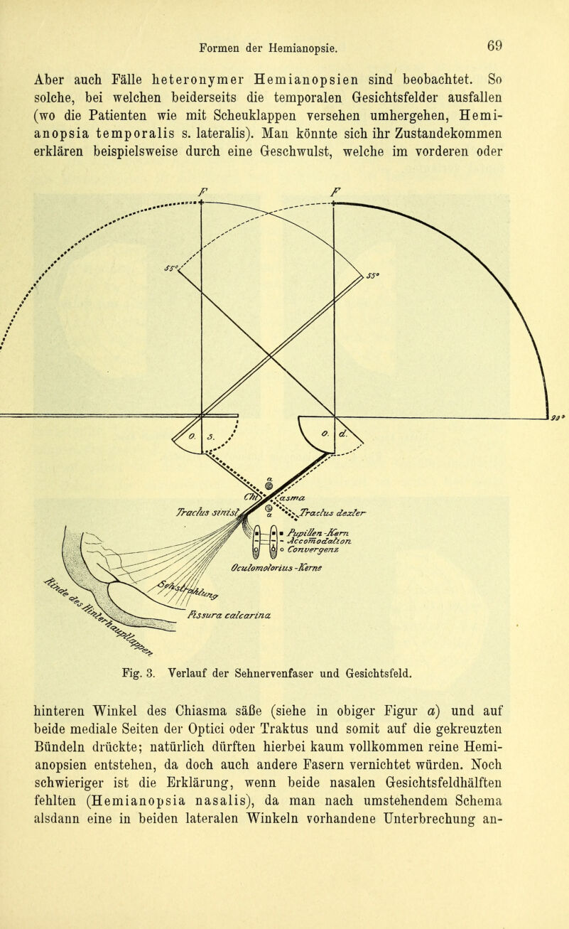 Aber auch Fälle heteronymer Hemianopsien sind beobachtet. So solche, bei welchen beiderseits die temporalen Gesichtsfelder ausfallen (wo die Patienten wie mit Scheuklappen versehen umhergehen, Hemi- anopsia temporalis s. lateralis). Man könnte sich ihr Zustandekommen erklären beispielsweise durch eine Geschwulst, welche im vorderen oder F F Fig. 3. Verlauf der Sehnervenfaser und Gesichtsfeld. hinteren Winkel des Chiasma säße (siehe in obiger Figur a) und auf beide mediale Seiten der Optici oder Traktus und somit auf die gekreuzten Bündeln drückte; natürlich dürften hierbei kaum vollkommen reine Hemi- anopsien entstehen, da doch auch andere Fasern vernichtet würden. Noch schwieriger ist die Erklärung, wenn beide nasalen Gesichtsfeldhälften fehlten (Hemianopsia nasalis), da man nach umstehendem Schema alsdann eine in beiden lateralen Winkeln vorhandene Unterbrechung an-