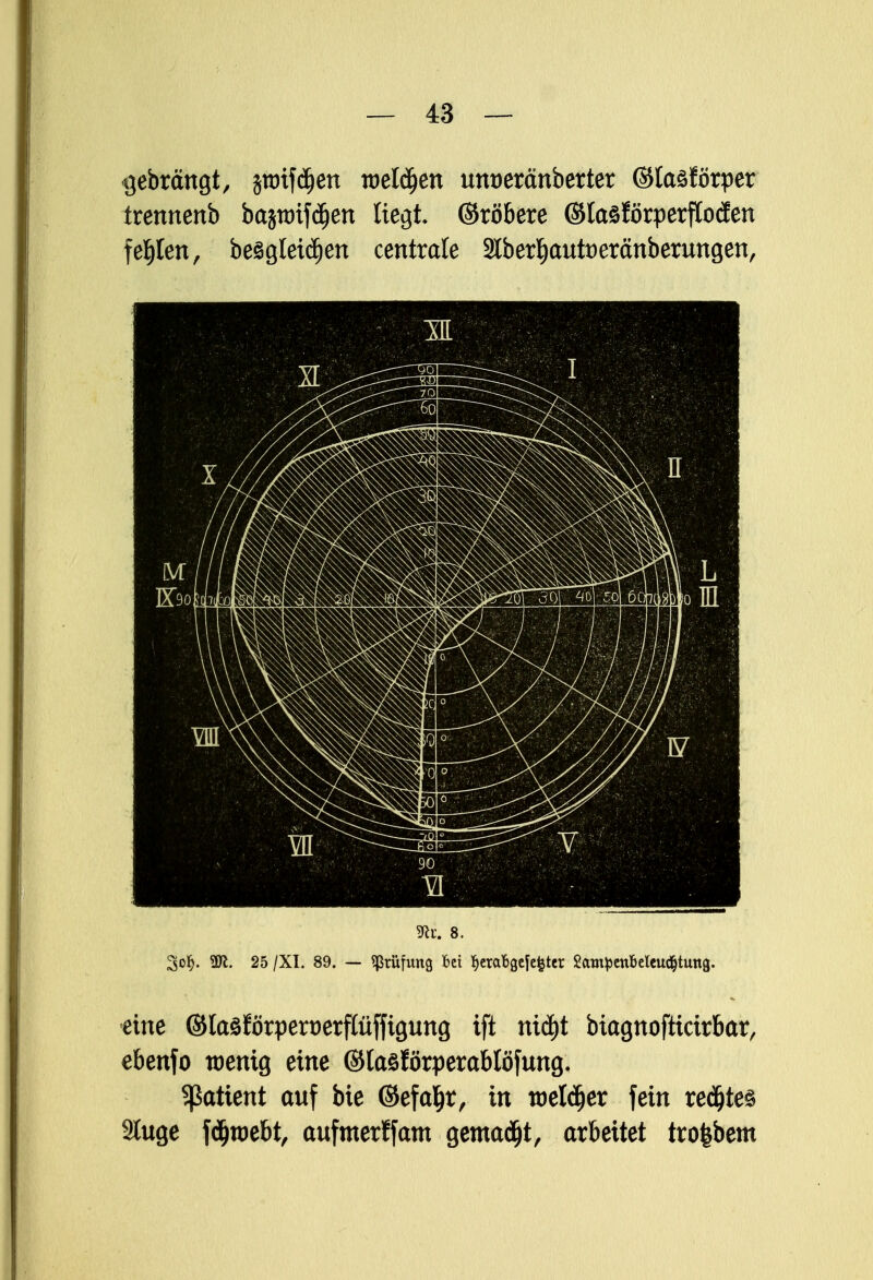 gebrängt, prifcfjen roeldjen untjercmberter ©laöförper trennenb bajtmfdjen liegt ©röbere ©lasförperffoden fehlen, besgletdjen centrale 2lber|autt)eränberungen, 9fa. 8. 3o§. 2K. 25 /XI. 89. — Prüfung M l)etaBgeye^tcr SamjjenMeud&tung. eine ©laöJörpert)erflüffigung ift ni$t biagnofttcirbar, ebenfo wenig eine ©laöförperablöfung. Patient auf bie ©efaljr, in roeldjer fein redjte«! Sluge fdjroebt, aufmerffam gemalt, arbeitet trofebem