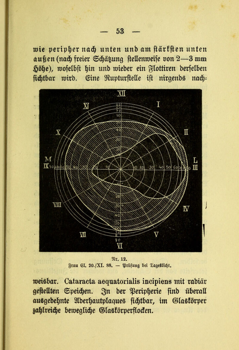 wie peripher nad) unten unb am ftärfften unten aufcen (naü) freier ©d)ä£ung fteßenroeife von 2—3 mm ^öJ>e)r tt)ofeIbft f)tn unb ttrieber ein glottiren berfelben ftdjtbar wirb. (Sine SiupturfteHe ift mrgenbö nafy m. i2. grau Gl. 20./XI. 88. - Prüfung bei £age§Hdjt. roetebar. Cataracta aequatorialis incipiens mit rabictr gefüllten ©peilen. $n ber ^eripljerie ftnb überaß ausgebeljnte Slberljautplaques ftdjtbar, im ©laSförper jaljlreidje beroeglidje ©laöförperftodten.