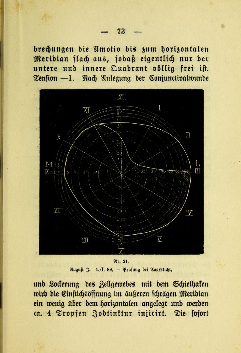 bredjungen bie Stmotio &U jum l)ortjontalen 3J?eribtan fIa<^ au§, fobafc eigentlich nur ber untere unb innere Duabrant tjölltg frei ift. £enfion —1. 9ta<3) Anlegung ber Goniuncttoatnmnbe m. 21. Sluguft 3. 4./I. 89. — Prüfung M SageSItdjt. unb Soderung bes Settseroebea mit bem ©djielljafen wirb bie 6inftt<$söffnung im äußeren fdjrägen üfleribian ein wenig über bem tjorijontalen angelegt unb werben ca, 4 tropfen Sobtinftur injicirt Sie fofort