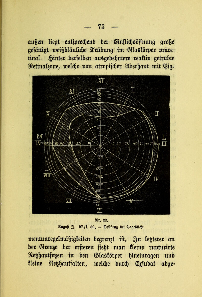 aufjen liegt entfpredjenb ber (Sinfti^ööffnung grofce gefättigt roeipiäuliäje Trübung im ©laSförper präre- tinal, hinter berfelben ausgebe^ntere reaftit) getrübte Sftetinaljone, roeldje von atropifdjer Slber^aut mit Sßig- 5ßt. 22. Stugufi 3. 27./I. 89. - Prüfung bei £age3Ii<$t. mentunregelmäfngJeiten begrenzt ift, 3n legerer an ber ©renje ber erfteren fieljt man fleine rupturirte 9ie$)autfefeen in ben ©laöförper hineinragen unb fleine 9lefel)autf alten, toeldje burdj ©sfubat abge=