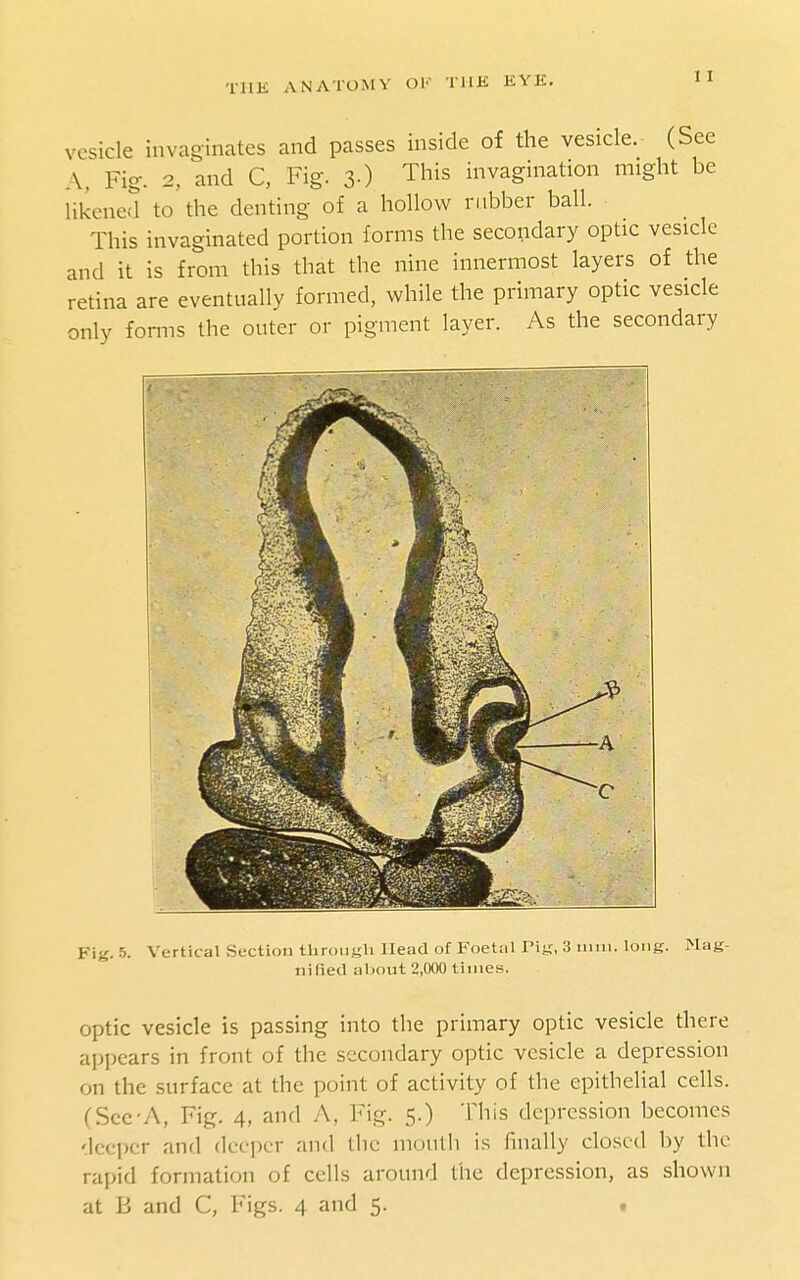 vesicle invaginates and passes inside of the vesicle. (See A, Fig. 2, and C, Fig. 3-) This invagination might be likened to the denting of a hollow rubber ball. This invaginated portion forms the secondary optic vesicle and it is from this that the nine innermost layers of the retina are eventually formed, while the primary optic vesicle only forms the outer or pigment layer. As the secondary FiK. 5. Vertical Section throiiyli Head of Foetal Pin, 3 nun. long. Mag- nified about 2,000 times. optic vesicle is passing into the primary optic vesicle there appears in front of the secondary optic vesicle a depression on the surface at the point of activity of the epithelial cells. (Scc'A, Fig. 4, and A, Fig. 5.) This depression becomes deeper and deeper and the muutli is finally closed by the rapid formation of cells around the depression, as shown