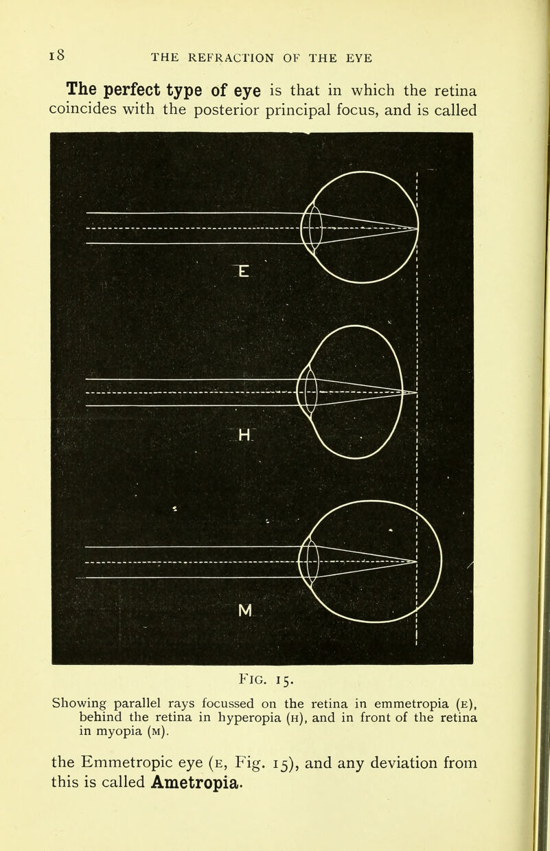 The perfect type Of eye is that in which the retina coincides with the posterior principal focus, and is called 1 1 - XJ V ■ 1 Fig. 15. Showing parallel rays focussed on the retina in emmetropia (e), behind the retina in hyperopia (h), and in front of the retina in myopia (m). the Emmetropic eye (e, Fig. 15), and any deviation from this is called Ametropia.