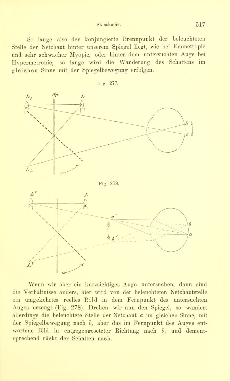 So lange also der konjungierte Brennpunkt der beleuchteten Stelle der Netzhaut hinter unserem Spiegel liegt, wie bei Emmetropie und sehr schwacher Myopie, oder hinter dem untersuchten Auge bei Hypermetropie, so lange wird die Wanderung des Schattens im gleichen Sinne mit der Spiegelbewegung erfolgen. Fig. 277. Wenn wir aber ein kurzsichtiges Auge untersuchen, dann sind die Verhältnisse anders, hier wird von der beleuchteten Netzhautstelle ein umgekehrtes reelles Bild in dem Fernpunkt des untersuchten Auges erzeugt (Fig. 278). Drehen wir nun den Spiegel, so wandert allerdings die beleuchtete Stelle der Netzhaut a im gleichen Sinne, mit der Spiegelbewegung nach b: aber das im Fernpunkt des Auges ent- worfene Bild in entgegengesetzter Richtung nach bi und dement- sprechend rückt der Schatten nach.