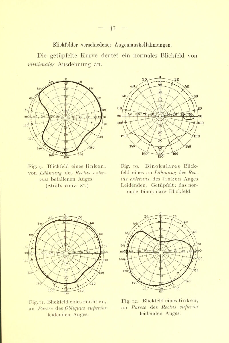 Blickfelder verschiedener Angeumuskellälimiiiigeri. Die getüpfelte Kurve deutet ein normales Blickfeld von minimaler Ausdehnung an. Fig. 9. Blickfeld eines linken, Fig. 10. Binokulares Blick- von Lähnmng des Rechts exter- feld eines an Lähmung des Rec- nus befallenen Auges. tus externus des linken Auges (Strab. conv. 8°.) Leidenden. Getüpfelt: das nor- male binokulare Blickfeld. Fig. II. Blickfeld eines rechten, Fig. 12. Blickfeld eines linken, an Parese des Obliquus superior an Parese des Rectus siiperior leidenden Auges. leidenden Auges.