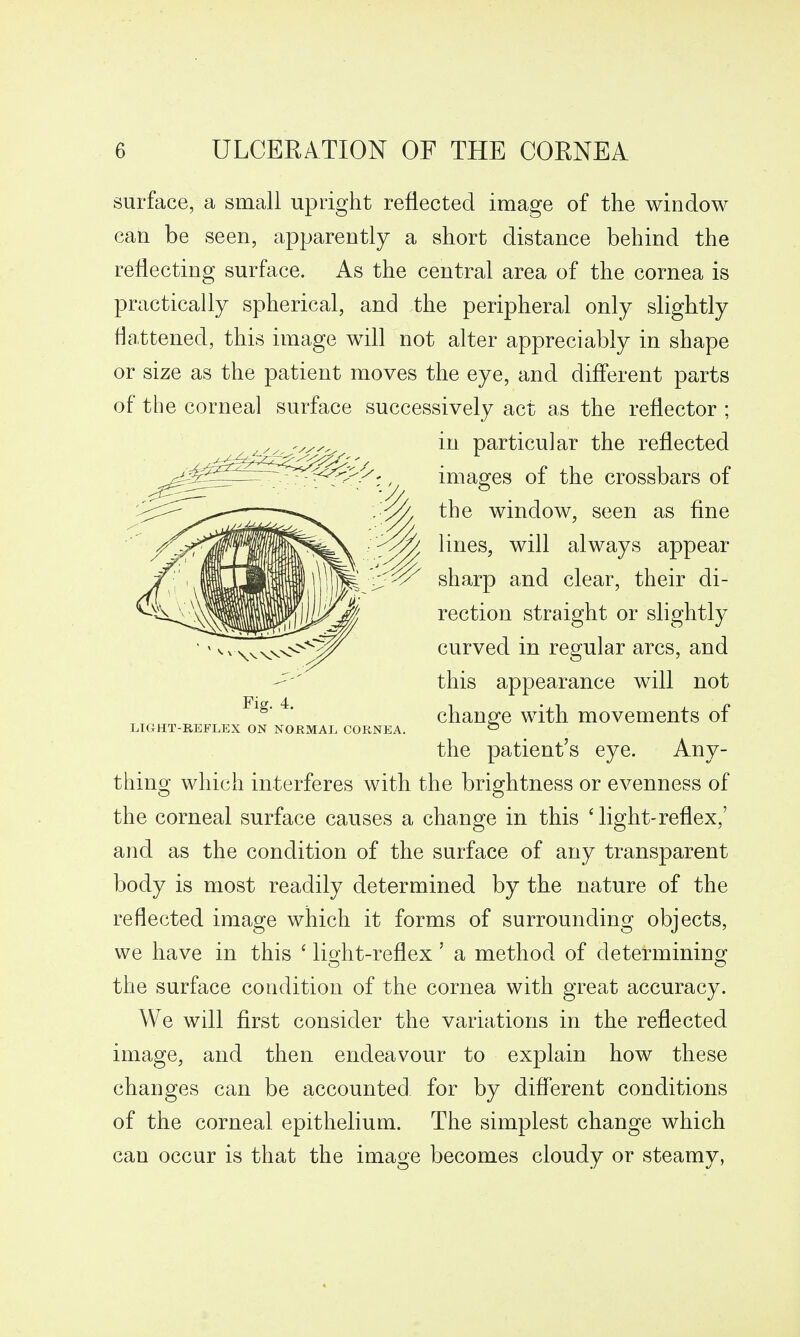 surface, a small upright reflected image of the window can be seen, apparently a short distance behind the reflecting surface. As the central area of the cornea is practically spherical, and the peripheral only slightly flattened, this image will not alter appreciably in shape or size as the patient moves the eye, and different parts of the corneal surface successively act as the reflector ; in particular the reflected images of the crossbars of the window, seen as fine lines, will always appear sharp and clear, their di- rection straight or slightly curved in regular arcs, and this appearance will not change with movements of the patient's eye. Any- thing which interferes with the brightness or evenness of the corneal surface causes a change in this ' light-reflex,' and as the condition of the surface of any transparent body is most readily determined by the nature of the reflected image which it forms of surrounding objects, we have in this ' liofht-reflex' a method of determinino^ the surface condition of the cornea with great accuracy. We will first consider the variations in the reflected image, and then endeavour to explain how these changes can be accounted, for by different conditions of the corneal epithelium. The simplest change which can occur is that the image becomes cloudy or steamy, Fig. 4. LIGHT-REFLEX ON NORMAL CORNEA.