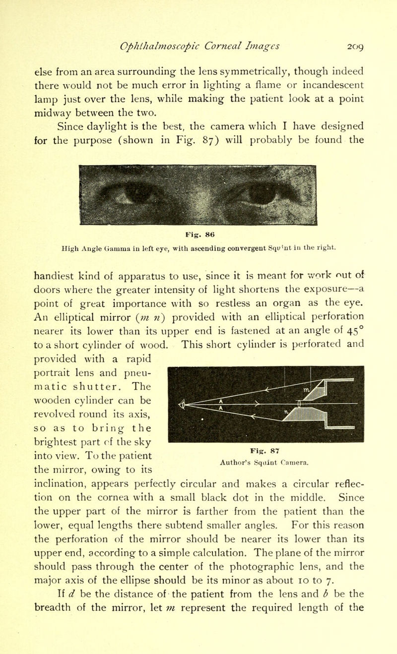 else from an area surrounding the lens symmetrically, though indeed there would not be much error in lighting a flame or incandescent lamp just over the lens, while making the patient look at a point midway between the two. Since daylight is the best, the camera which I have designed for the purpose (shown in Fig. 87) will probably be found the Fig. 86 High Angle Gamma iu left eye, with ascending convergent Squint in the right. handiest kind of apparatus to use, since it is meant for Vv^ork nut of doors where the greater intensity of light shortens the exposure—a point of great importance with so restless an organ as the eye. An elliptical mirror {in 71) provided with an elliptical perforation nearer its lower than its upper end is fastened at an angle of 45° to a short cylinder of wood. This short cyHnder is perforated and provided with a rapid portrait lens and pneu- matic shutter. The wooden cylinder can be revolved round its axis, so as to bring the brightest part of the sky into view. To the patient . . . Author's Squint Camera. the mirror, owmg to its inclination, appears perfectly circular and makes a circular reflec- tion on the cornea with a small black dot in the middle. Since the upper part of the mirror is farther from the patient than the lower, equal lengths there subtend smaller angles. For this reason the perforation of the mirror should be nearer its lower than its upper end, according to a simple calculation. The plane of the mirror should pass through the center of the photographic lens, and the major axis of the ellipse should be its minor as about 10 to 7. If d be the distance of the patient from the lens and b be the breadth of the mirror, let in represent the required length of the