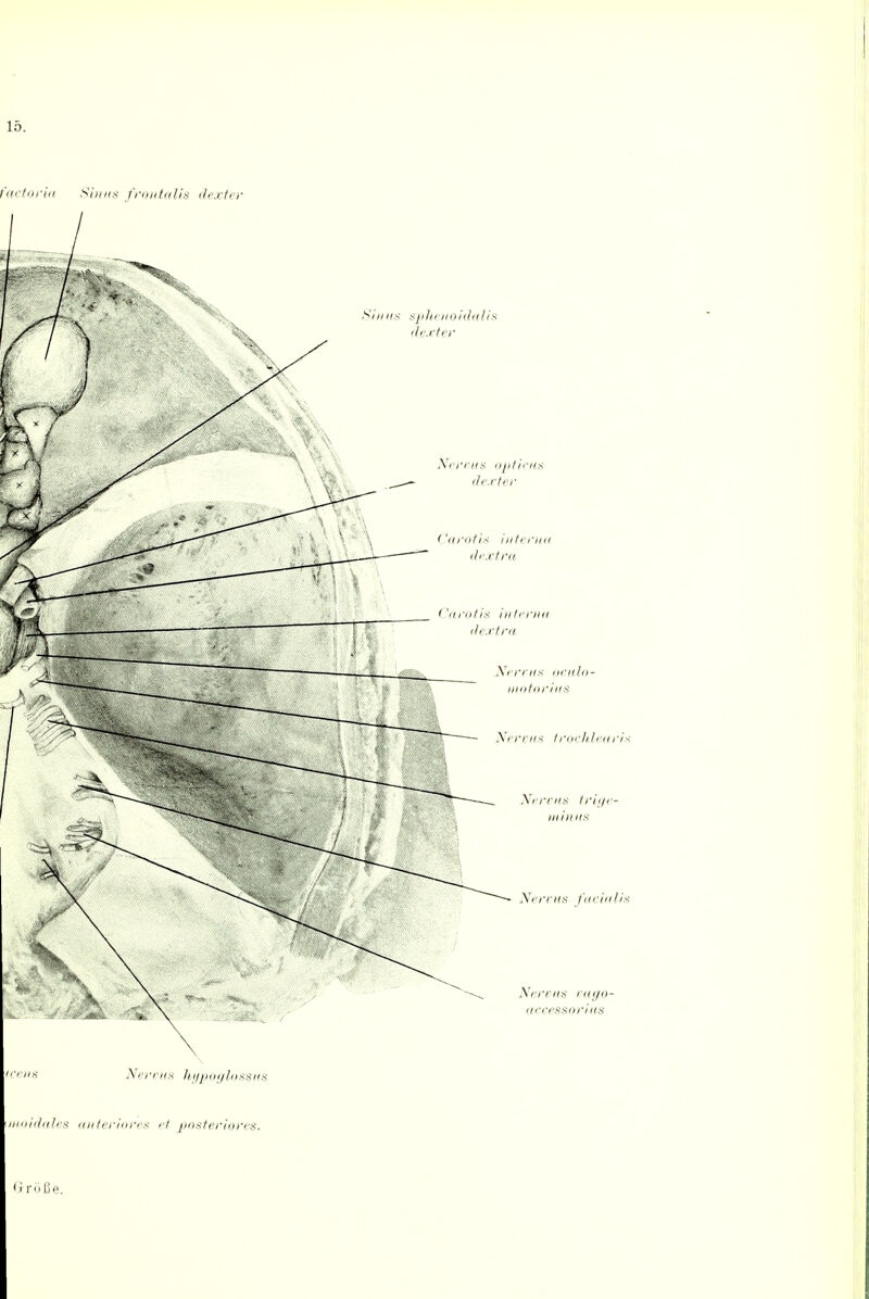 enoidalis ter Nervus opticus dextei' Carotis interna dextra Carotis interna dextra Nervus oculo- motorius Nervus trochlearis Nervus trige- minus Nervus facialis Nervus vago- accessorius