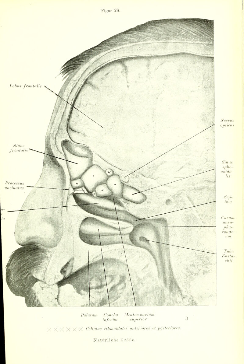 Figur 26. 1'iihttiiin (,'oiicha Meatus narium in ferior sujjerior ' X X X X X Cellulae ethmoidales anteriores et posteriores. Natürliche i> rö ße.