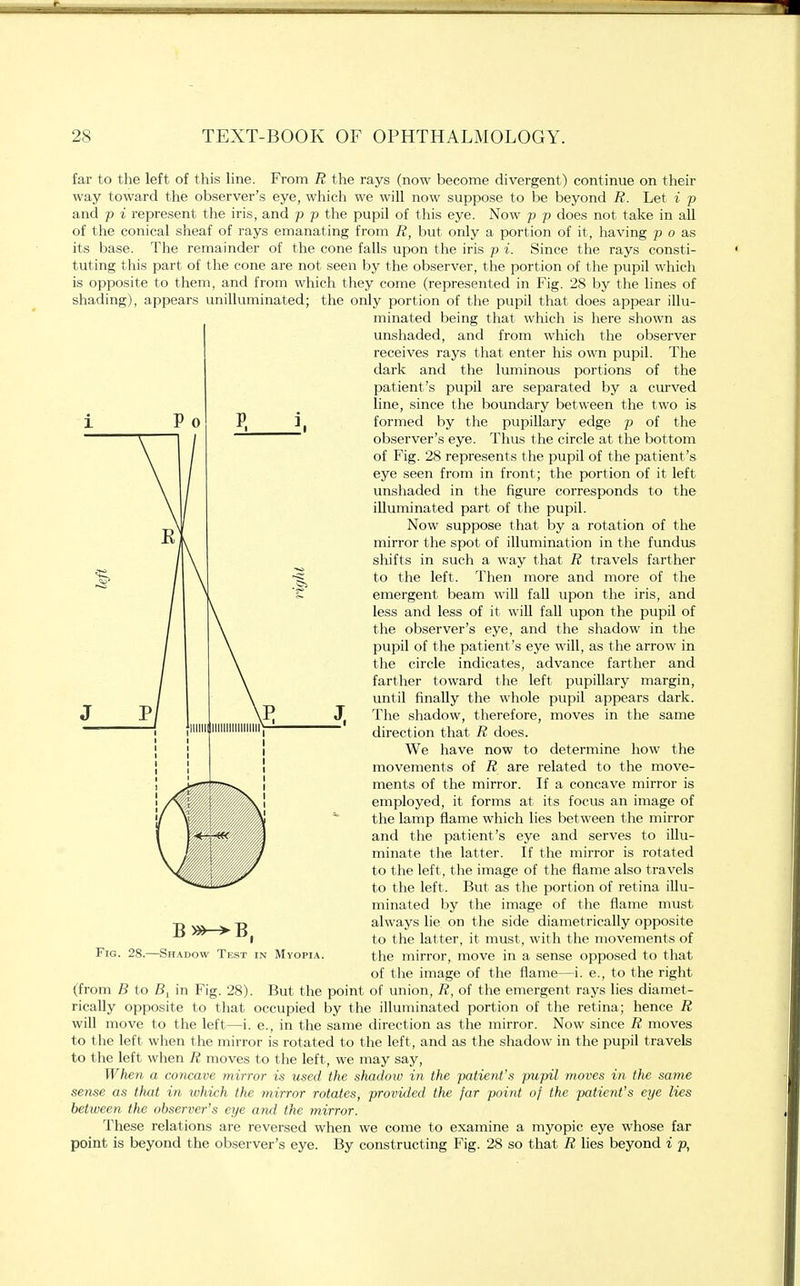 far to the left of this line. From R the rays (now become divergent) continue on their way toward the observer's eye, which we will now suppose to be beyond R. Let i p and p i represent the iris, and p p the pupil of this eye. Now p p does not take in all of the conical sheaf of rays emanating from R, but only a portion of it, having p o as its base. The remainder of the cone falls upon the iris p i. Since the rays consti- tuting this part of the cone are not seen by the observer, the portion of the pupil which is opposite to them, and from which they come (represented in Fig. 28 by the lines of shading), appears unilluminated; the only portion of the pupil that does appear illu- minated being that which is here shown as unshaded, and from which the observer receives rays that enter his own pupil. The dark and the luminous portions of the patient's pupil are separated by a curved line, since the boundary between the two is formed by the pupillary edge p of the observer's eye. Thus the circle at the bottom of Fig. 28 represents the pupil of the patient's eye seen from in front; the portion of it left unshaded in the figure corresponds to the illuminated part of the pupil. Now suppose that by a rotation of the mirror the spot of illumination in the fundus shifts in such a way that R travels farther to the left. Then more and more of the emergent beam will fall upon the iris, and less and less of it will fall upon the pupil of the observer's eye, and the shadow in the pupil of the patient 's eye will, as the arrow in the circle indicates, advance farther and farther toward the left pupillary margin, until finally the whole pupil appears dark. The shadow, therefore, moves in the same direction that R does. We have now to determine how the movements of R are related to the move- ments of the mirror. If a concave mirror is employed, it forms at its focus an image of the lamp flame which lies between the mirror and the patient's eye and serves to illu- minate the latter. If the mirror is rotated to the left, the image of the flame also travels to the left. But as the portion of retina illu- minated by the image of the flame must always lie on the side diametrically opposite to the latter, it must, with the movements of the mirror, move in a sense opposed to that of the image of the flame—i. e., to the right (from B to B, in Fig. 28). But the point of union, R, of the emergent rays lies diamet- rically opposite to that occupied by the illuminated portion of the retina; hence R will move to the left—i. e., in the same direction as the mirror. Now since R moves to the left when the mirror is rotated to the left, and as the shadow in the pupil travels to the left when R moves to the left, we may say, When a concave mirror is used the shadow in the patient's pupil moves in the same sense as that in which the mirror rotates, provided the jar point of the patient's eye lies between the observer's eye and the mirror. These relations are reversed when we come to examine a myopic eye whose far point is beyond the observer's eye. By constructing Fig. 28 so that R lies beyond i p, B »^B Fig. 28.—Shadow Test in Myopia.