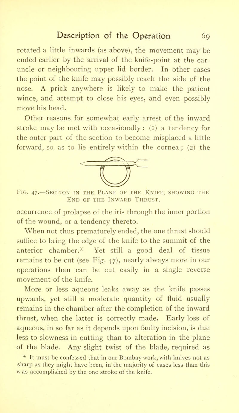 rotated a little inwards (as above), the movement may be ended earlier by the arrival of the knife-point at the car- uncle or neighbouring upper lid border. In other cases the point of the knife may possibly reach the side of the nose. A prick anywhere is likely to make the patient wince, and attempt to close his eyes, and even possibly move his head. Other reasons for somewhat early arrest of the inward stroke may be met with occasionally : (i) a tendency for the outer part of the section to become misplaced a little forward, so as to lie entirely within the cornea ; (2) the Fig. 47.—Section in the Plane of the Knife, showing the End of the Inward Thrust. occurrence of prolapse of the iris through the inner portion of the wound, or a tendency thereto. When not thus prematurely ended, the one thrust should suffice to bring the edge of the knife to the summit of the anterior chamber.^ Yet still a good deal of tissue remains to be cut (see Fig. 47), nearly always more in our operations than can be cut easily in a single reverse movement of the knife. More or less aqueous leaks away as the knife passes upwards, yet still a moderate quantity of fluid usually remains in the chamber after the completion of the inward thrust, when the latter is correctly made. Early loss of aqueous, in so far as it depends upon faulty incision, is due less to slowness in cutting than to alteration in the plane of the blade. Any slight twist of the blade, required as It must be confessed that in our Bombay work, with knives not as sharp as they might have been, in the majority of cases less than this w as accomplished by the one stroke of the knife.