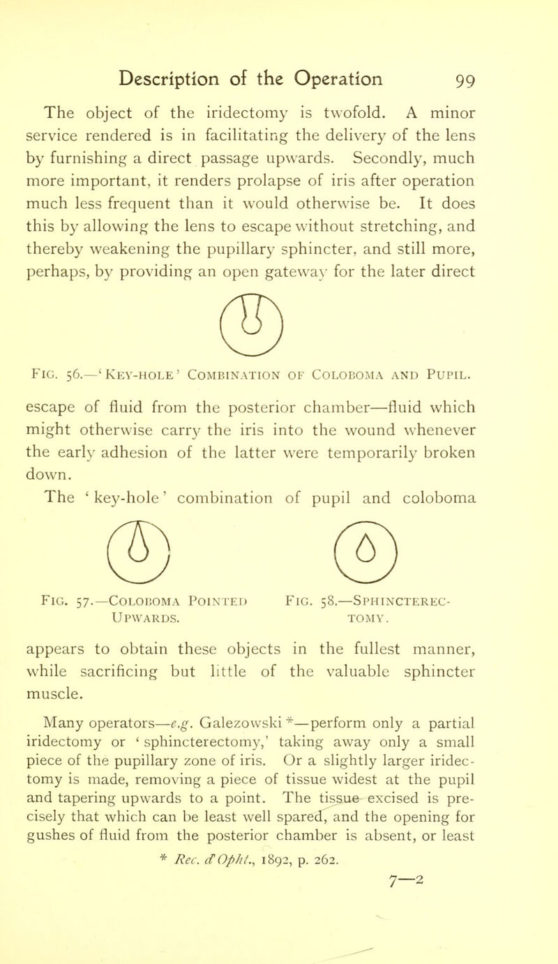 The object of the iridectomy is twofold. A minor service rendered is in facihtating the dehvery of the lens by furnishing a direct passage upwards. Secondly, much more important, it renders prolapse of iris after operation much less frequent than it would otherwise be. It does this by allowing the lens to escape without stretching, and thereby weakening the pupillary sphincter, and still more, perhaps, by providing an open gatewa\- for the later direct Fig. 56.—' Key-hole' Combination of Coloboma and Pupil. escape of fluid from the posterior chamber—fluid which might otherwise carr}^ the iris into the wound whenever the early adhesion of the latter were temporarily broken down. The ' key-hole' combination of pupil and coloboma Fig. 57.—Coloboma Pointed Fig. 58.—Sphincterec- Upwards. tomy. appears to obtain these objects in the fullest manner, while sacrificing but little of the valuable sphincter muscle. Many operators—e.g. Galezowski ^—perform only a partial iridectomy or ' sphincterectomy,' taking away only a small piece of the pupillary zone of iris. Or a slightly larger iridec- tomy is made, removing a piece of tissue widest at the pupil and tapering upwards to a point. The tissue excised is pre- cisely that which can be least well spared, and the opening for gushes of fluid from the posterior chamber is absent, or least * Rec. dOpht., 1892, p. 262. 7—2