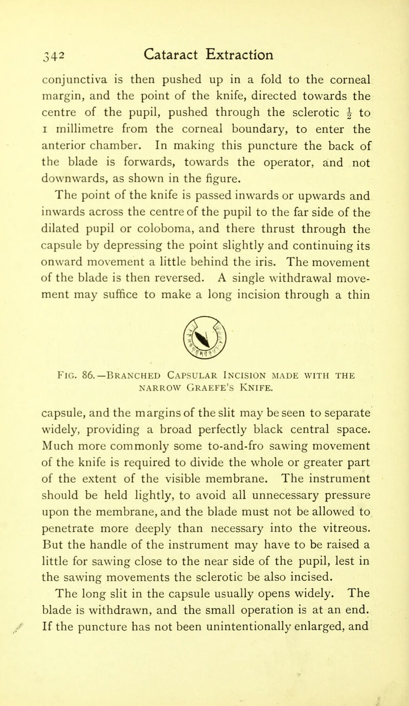 conjunctiva is then pushed up in a fold to the corneal margin, and the point of the knife, directed towards the centre of the pupil, pushed through the sclerotic J to I millimetre from the corneal boundary, to enter the anterior chamber. In making this puncture the back of the blade is forwards, towards the operator, and not downwards, as shown in the figure. The point of the knife is passed inwards or upwards and inwards across the centre of the pupil to the far side of the dilated pupil or coloboma, and there thrust through the capsule by depressing the point slightly and continuing its onward movement a little behind the iris. The movement of the blade is then reversed. A single withdrawal move- ment may suffice to make a long incision through a thin Fig. 86.—Branched Capsular Incision made with the NARROW GRAEFE'S KNIFE. capsule, and the margins of the slit may be seen to separate widely, providing a broad perfectly black central space. Much more commonly some to-and-fro sawing movement of the knife is required to divide the whole or greater part of the extent of the visible membrane. The instrument should be held lightly, to avoid all unnecessary pressure upon the membrane, and the blade must not be allowed to penetrate more deeply than necessary into the vitreous. But the handle of the instrument may have to be raised a little for sawing close to the near side of the pupil, lest in the sawing movements the sclerotic be also incised. The long slit in the capsule usually opens widely. The blade is withdrawn, and the small operation is at an end. If the puncture has not been unintentionally enlarged, and