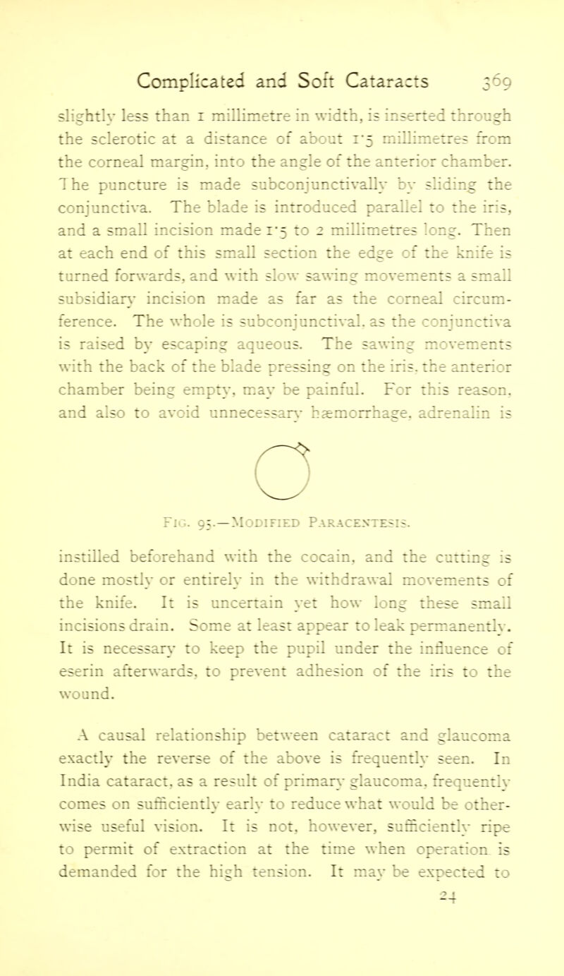 slightly less than i millimetre in w^idth, is insertei through the sclerotic at a distance of about 1*5 ntihintrtres from the corneal margin, into the angle of the anterior chamber. The puncture is made subconjunctivally by shding the conjunctiva. The blade is introduced parallel to the iris, and a small incision made i'5 zd 2 millimetres long. Then at each end of this small section the edge :: the knh'e is turned forwards, and with slow sawing movements a small subsidiar}- incision made as far as the corneal circum- ference. The whole is subconjunctival, as the conjunctiva is raised by escaping aqueous. The sawing ntcventents with the back of the blade pressing on the iris, the anterior chamber being empty, may be painful. For this reason, and also to avoid unnecessary- haemorrhage, adrenalin is Fig. 95.—Modified Paracentesis. instilled beforehand with the cocain, and the cutting is done mostly or entirely in the withdrawal n::ven:ents of the knife. It is uncertain yet how long these small incisions drain. Some at least appear to leak permanentlv. It is necessary to keep the pupil under the influence of eserin afterwards, to prevent adhesion of the iris to the wound. A causal relationship between cataract and glaucoma exactly the reverse of the above is frequently seen. In India cataract, as a result of primar}- glaucoma, frequently comes on sutiiciently early to reduce what would be other- wise useful vision. It is not, however, sufl&ciently ripe to permit of extraction at the time when operation is demanded for the high tension. It may be expected to ^4