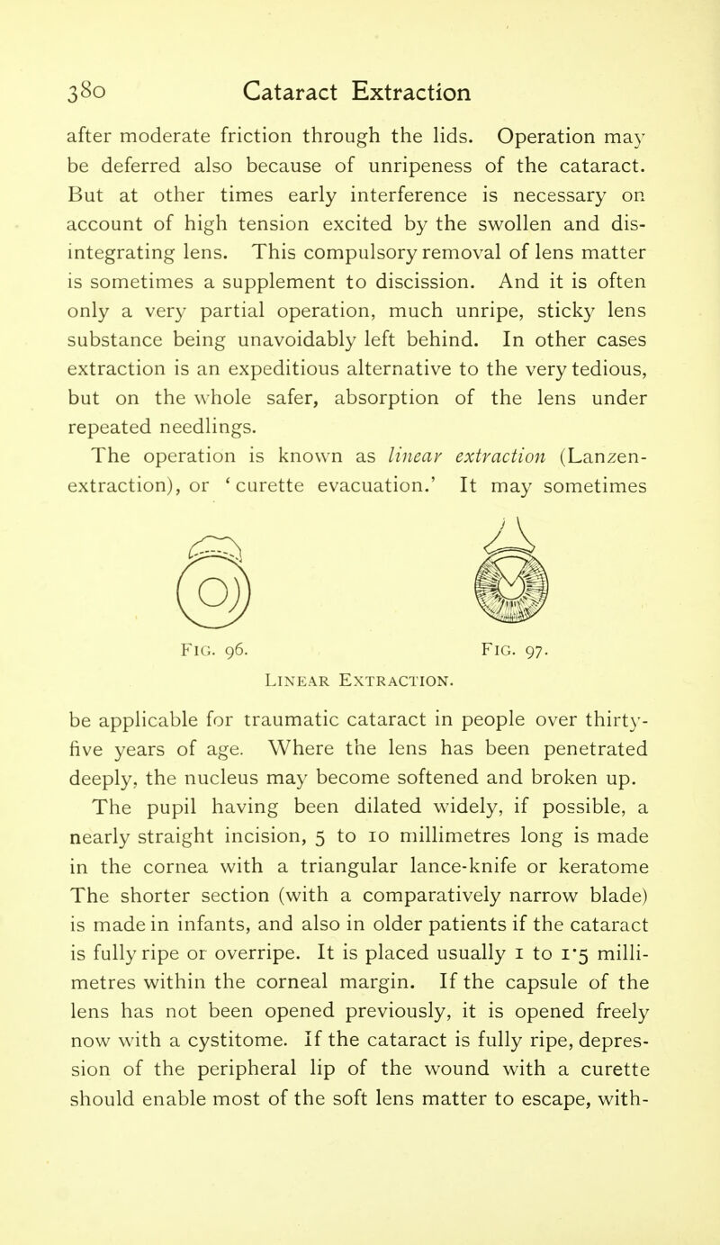 after moderate friction through the Hds. Operation may be deferred also because of unripeness of the cataract. But at other times early interference is necessary on account of high tension excited by the swollen and dis- integrating lens. This compulsory removal of lens matter is sometimes a supplement to discission. And it is often only a very partial operation, much unripe, sticky lens substance being unavoidably left behind. In other cases extraction is an expeditious alternative to the very tedious, but on the whole safer, absorption of the lens under repeated needlings. The operation is known as linear extraction (Lanzen- extraction), or 'curette evacuation.' It may sometimes Fig. 96. Fig. 97. Linear Extraction. be applicable for traumatic cataract in people over thirty- five years of age. Where the lens has been penetrated deeply, the nucleus may become softened and broken up. The pupil having been dilated widely, if possible, a nearly straight incision, 5 to 10 millimetres long is made in the cornea with a triangular lance-knife or keratome The shorter section (with a comparatively narrow blade) is made in infants, and also in older patients if the cataract is fully ripe or overripe. It is placed usually i to 1*5 milli- metres within the corneal margin. If the capsule of the lens has not been opened previously, it is opened freely now with a cystitome. If the cataract is fully ripe, depres- sion of the peripheral lip of the wound with a curette should enable most of the soft lens matter to escape, with-