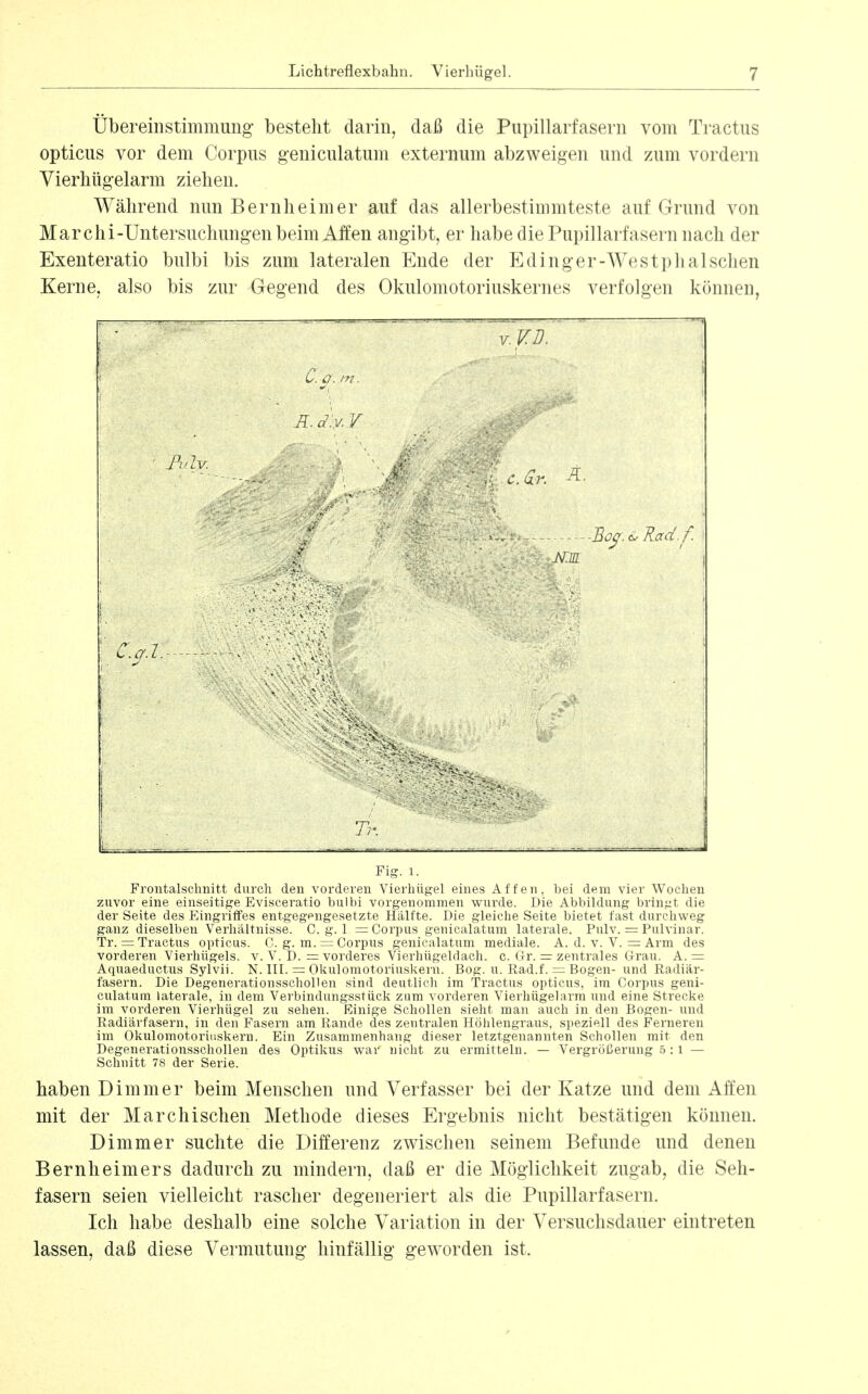 Übereinstimmung besteht darin, daß die Pupillarfasern vom Tractus opticus vor dem Corpus geniculatum externum abzweigen und zum vordem Vierhügelarm ziehen. Während nun Bernheim er auf das allerbestimmteste auf Grund von Mar chi-Untersuchungen beim Affen angibt, er habe die Pupillarfasern nach der Exenteratio bulbi bis zum lateralen Ende der Edinger-Westphalschen Kerne, also bis zur Gegend des Okulomotoriuskernes verfolgen können, - u 1. -r^ : . ..^^ Y.vn. i- C. o. m. I- K.ol:y.Y . - >.. Büß. <£' Rad. f. i JsrjR ' i ■ C.a.l.- ----^^^ ■ , ' _ J , ■■> V. V . Fig. 1. Frontalschnitt durch den vorderen Vierhügel eines Affen, bei dem vier Wochen zuvor eine einseitige Evisceratio bulbi vorgenommen wurde. Die Abbildung bringt die der Seite des Eingriffes entgegengesetzte Hälfte. Die gleiche Seite bietet fast durchweg ganz dieselben Verhältnisse. C. g. 1 = Corpus genicalatum laterale. Pulv. == Pulvinar. Tr. = Tractus opticus. C. g. m. = Corpus genicalatum mediale. A. d. v. V. = Arm des vorderen Vierhügels, v. V. D. = vorderes Vierhügeldach. c. Gr. =r zentrales Grau. A. = Aquaeductus Sylvii. N. III. = Okulomotoriuskern. Bog. u. Rad.f. = Bogen- und Radiär- fasern. Die Degenerationsschollen sind deutlich im Tractus opticus, im Corpus geni- culatum laterale, in dem Verbindungsstück zum voi'deren Vierhügelarm und eine Strecke im vorderen Vierhügel zu sehen. Einige Schollen sieht man auch in den Bogen- und Radiärfasern, in den Fasern am Rande des zentralen Höhlengraus, speziell des Ferneren im Okulomotoriuskern. Ein Zusammenhang dieser letztgenannten Schollen mit den Degenerationsschollen des Optikus war nicht zu ermitteln. — Vergrößerung 5 : i — Schnitt 78 der Serie. haben Dimmer beim Menschen und Verfasser bei der Katze und dem Affen mit der Marchischen Methode dieses Ergebnis nicht bestätigen können. Dimmer suchte die Differenz zwischen seinem Befunde und denen Bernheim er s dadurch zu mindern, daß er die Möglichkeit zugab, die Seh- fasern seien vielleicht rascher degeneriert als die Pupillarfasern. Ich habe deshalb eine solche Variation in der Versuchsdauer eintreten lassen, daß diese Vermutung hinfällig geworden ist.