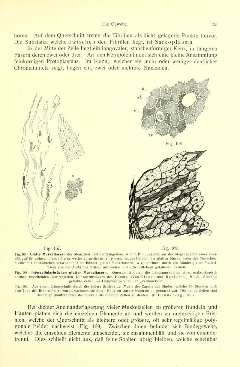 hören. Auf dem Querschnitt treten die Fibrillen als dicht gelagerte Punkte hervor. Die Substanz, welche zwischen den Fibrillen liegt, ist Sarkoplasma. In der Mitte der Zelle liegt ein langovaler, stäbchenförmiger Kern; in längeren Fasern deren zwei oder drei. An den Kernpolen findet sich eine kleine Ansammlung feinkörnigen Protoplasmas. Im Kern, welcher ein mehr oder weniger deutliches Chromatinnetz zeigt, liegen ein, zwei oder mehrere Nucleolen. Fig. 168 Fig. 167. Fig. 169. Fig. 167. Glatte Muskelfasern des Menschen und der Säugetiere, a eine Bildungszelie aus der Magengegend eines zwei- zölligen; Schweinsembryos; b eine weiter vorgerücl{te; c—g^ versciiiedene Formen der glatten Musl<elfasern des Menschen; /i eine mit Fettl<örnchen versehene; i ein Bündel glatter Muskelfasern; k Querschnitt durch ein Bündel glatter Muskel- fasern von der Aorta des Ochsen mit vielen in die Schnittebene gefallenen Kernen. Fig. 168. Interzellularbrücken glatter Muskelfasern. Querschnitt durch die Längsmuskulatur eines makroskopisch normal aussehenden kontrahierten Dünndarmstückes des Hundes. (Von Klecki und Barfurth.) Ii hell, d dunkel gefärbte Zellen; Ik Lymphkörperchen; zb „Zellbrücken. Fig.,169. Aus einem Längsschnitt durch die äußere Schicht der Media der Carotis des Rindes, welche 5'<-, Stunden nach dem Tode des Rindes fixiert wurde, nachdem sie durch Kälte zu starker Kontraktion gebracht war. Die hellen Zellen sind als tätige (kontrahierte), die dunkeln als ruhende Zellen zu deuten. (B. Henneberg, 1901.) Bei dichter Aneinanderlagerung vieler Muskelzellen zu größeren Bündeln und Häuten platten sich die einzelnen Elemente ab und werden zu mehrseitigen Pris- men, welche der Querschnitt als kleinere oder größere, oft sehr regelmäßige poly- gonale Felder nachweist (Fig. 169). Zwischen ihnen befindet sich Bindegewebe, welches die einzelnen Elemente umscheidet, sie zusammenhält und sie von einander trennt. Dies schließt nicht aus, daß feine Spalten übrig bleiben, welche scheinbar