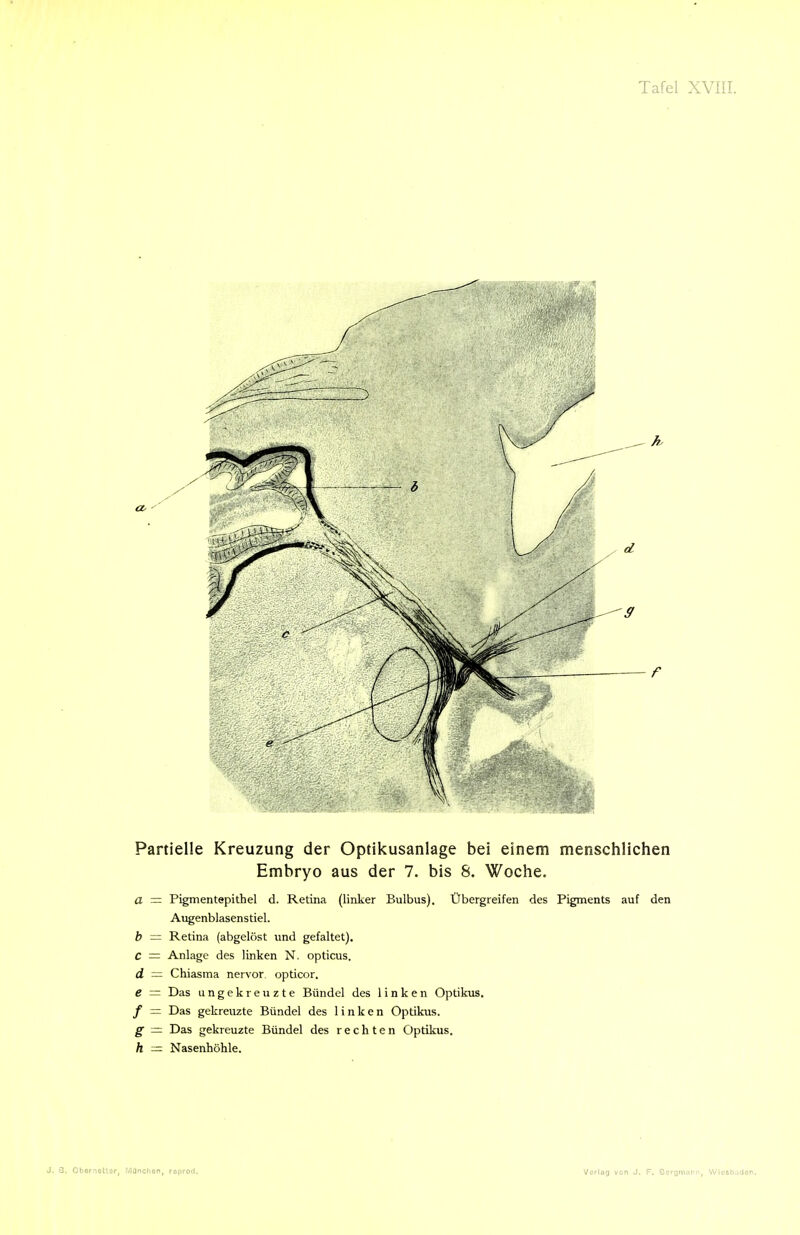 Partielle Kreuzung der Optikusanlage bei einem menschlichen Embryo aus der 7. bis 8. Woche. a = Pigmentepithel d. Retina (linker Bulbus). Übergreifen des Pigments auf den Augenblasenstiel. h — Retina (abgelöst und gefaltet), C = Anlage des linken N. opticus, d — Chiasma nervor opticor. e = Das ungekreuzte Bündel des linken Optikus. / = Das gekreuzte Bündel des linken Optikus. g = Das gekreuzte Bündel des rechten Optikus. h = Nasenhöhle.
