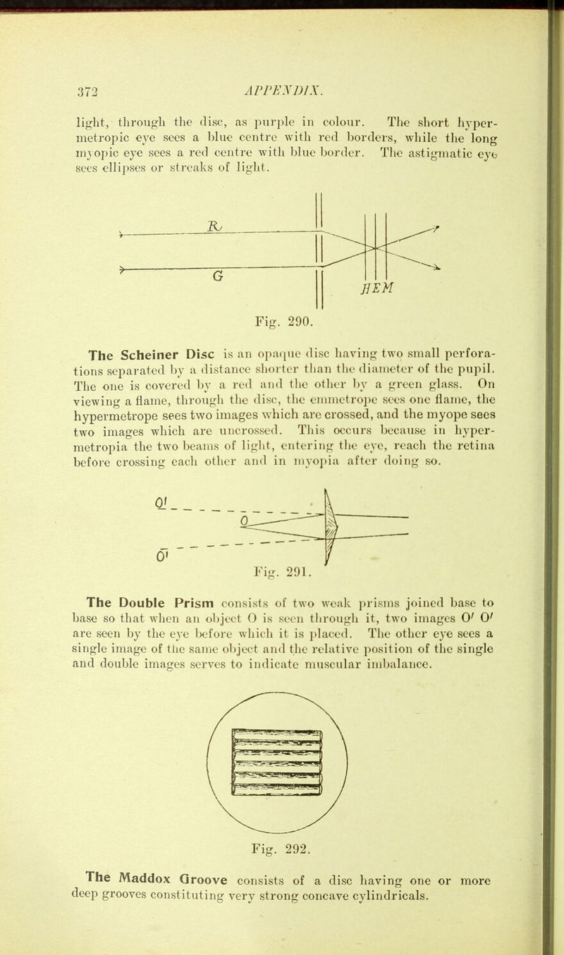 light, throiigli the disc, as purple in colour. The short In^per- metropic eye sees a blue centre with red borders, while the long myopic eye sees a red centre with blue border. The astigmatic eye sees ellipses or streaks of light. JJEM Fig. 290. The Scheiner Disc is an opaque disc having two small perfora- tions separated by a distance shorter tlian the diameter of the pupil. The one is covered by a red and tlie otlier by a green glass. On viewing a flame, through the disc, the emmet rope sees one flame, the hypermetrope sees two images which are crossed, and the myope sees two images which are uncrossed. This occurs because in hyper- metropia the two beams of light, entering the eye, reach the retina before crossing each other and in myopia after doing so. The Double Prism consists of two weak prisms joined base to base so that when an object O is seen througli it, two images 0^ 0' are seen by the eye before which it is placed. The other eye sees a single image of the same object and the relative position of the single and double images serves to indicate muscular imbalance. Fig. 292. The Maddox Groove consists of a disc having one or more deep grooves constituting very strong concave cylindricals.