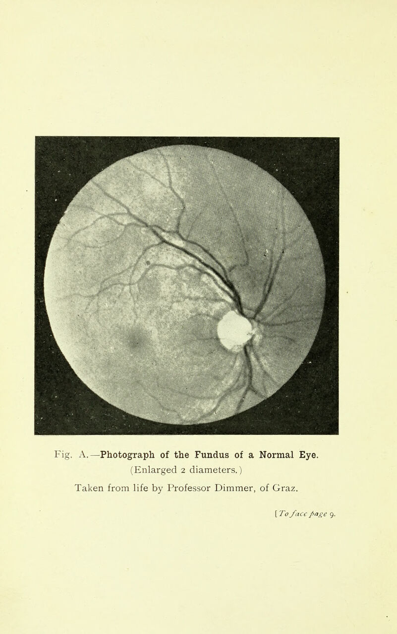 A.—Photograph of the Fundus of a Normal Eye. (Enlarged 2 diameters.) Taken from life by Professor Dimmer, of Graz. [ To face pige 9.