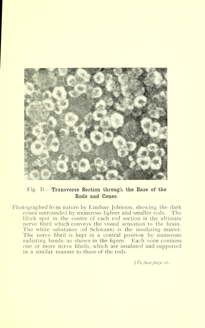 Fig. B.—Transverse Section through the Base of the Rods and Cones. Photographed from nature by Lindsay Johnson, showing the dark- cones surrounded by numerous hghter and smaller rods. The black spot in the centre of each rod section is the ultimate nerve fibril which conveys the visual sensation to the brain. The white substance (of Schwann) is the insulating matter. The nerve fibril is kept in a central position by numerous radiating bands, as shown in the figure. Each cone contains one or more nerve fibrils, which are insulated and supported in a similar manner to those of the rods. [ To face page. i6.