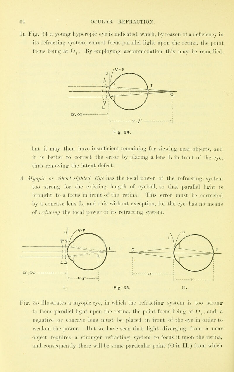 In Fig. 34: a young liy])eropic eye is indicated, which, by reason ot* a deficiency in its refracting system, cannot focus parallel light upon the retina, tlie point focus being at 0^. By employing accommodation this may be remedied, u -i f-Y ^ I tt V L U, OO \ ^ J <■ y-f— Fig. 34. 1 0| but it may then have insufficient renniining for viewing near objects, and it is better to correct the error by placing a lens L in front of the eye, thus removing the latent defect. A Miiopic or Short-sighted Eye has the focal power of the refracting system too strong for the existing length of eyeball, so that parallel light is brought to a focus in front of the retina. This error must be corrected by a concave lens L, and this without exception, for the eye lias no means of reducing the focal power of its refracting system. I. Fig. 35. II. Fig. o5 illustrates a myopic eye, in wliich the refracting system is too strong to focus parallel light upon tiie retina, the point focus being at (.),, and a negative or concave lens must be placed in front of the eye in order to weaken the power. But we have seen that light diverging from a near object requires a stronger refracting system to focus it upon the retina,