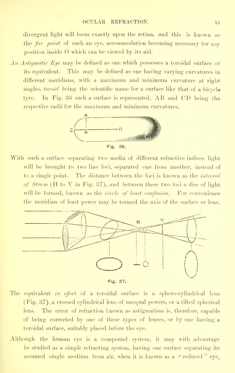 divergent light will t'oens exactly upon tlie retina, and this is known as the far point of such an eye, acconnnodation becoming necessary for any position inside O which can be viewed by its aid. An Astigmatic Et/e may be defined as one which possesses a toroidal surface or its equivalent. This may be defined as one having varying curvatures in different meridians, with a maximum and iminimum curvature at right angles, toroid being the scientific name for a surface like that of a bic\cle tyre. In Fig. 3(1 such a surface is represented, AB and CD being the respective radii for the maximum and minimum curvatures. Fig. 36. With sucli a surface separating two media of different refractive indices light will be brought to two line foci, separated one from another, instead of to a single point. Tlie distance between the foci is known as the interval of Sturm (H to y in Fig. 87), and between these two foci a disc of light will be formed, known as tlie circle of least confusion. For convenience the meridian of least power may be termed tlie axis of the surface or lens. Fig. 37. The equivalent in effect of a toroidal surface is a sphero-cylindrical lens (Fig. 37), a crossed cylindrical lens of unequal powers, or a tilted spherical lens. The error of refraction laiown as astigmatism is, therefore, capable of being corrected by one of these types of lenses, or by one having a toroidal surface, suitably placed before the eye. Altliough the human eye is a conjpound system, it may with advantage be studied as a simple refracting system, having one surface separating its assumed single medium from air, when it is known as a  reduced  eye,